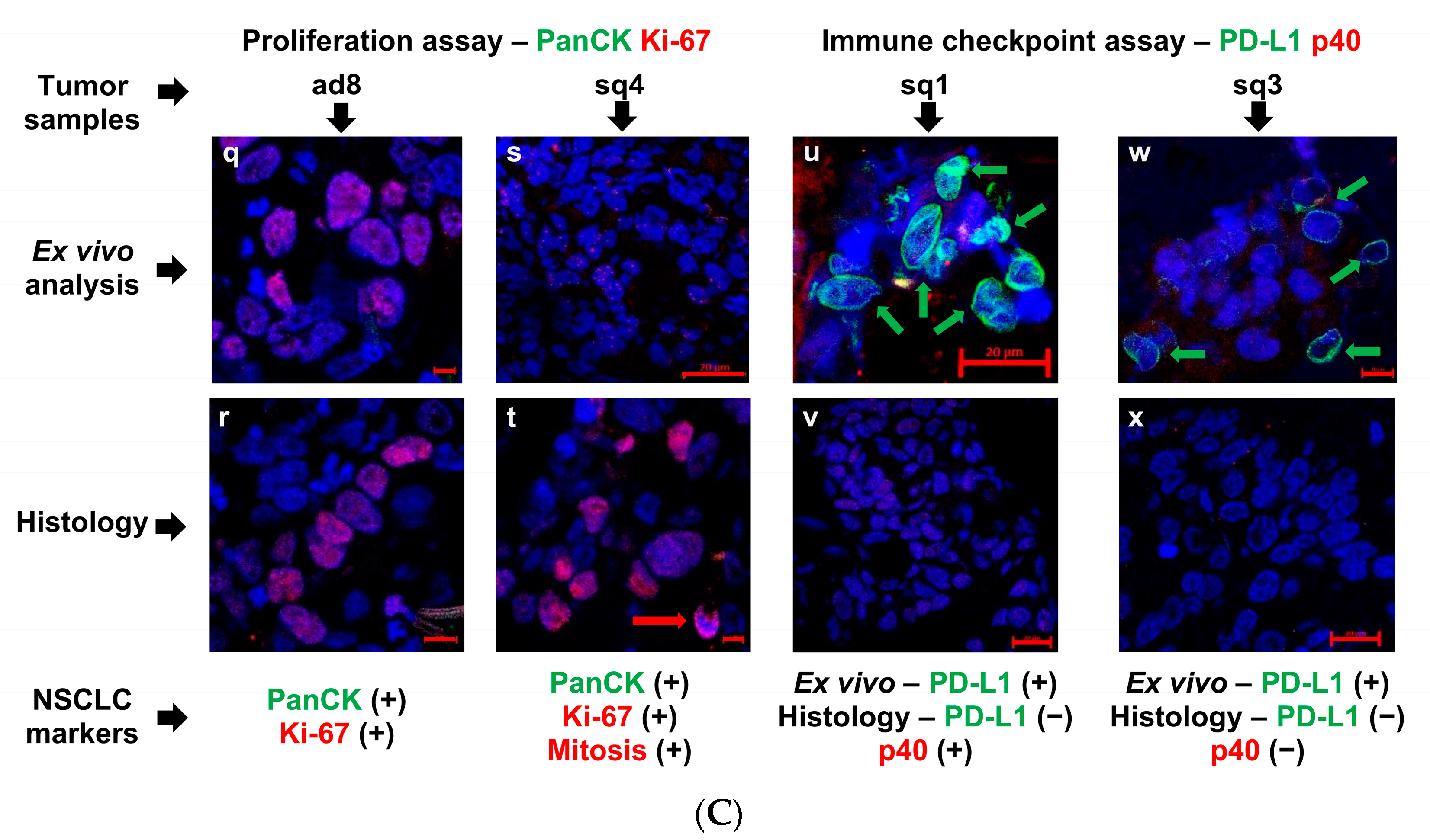 Cancers 16 02886 g003b