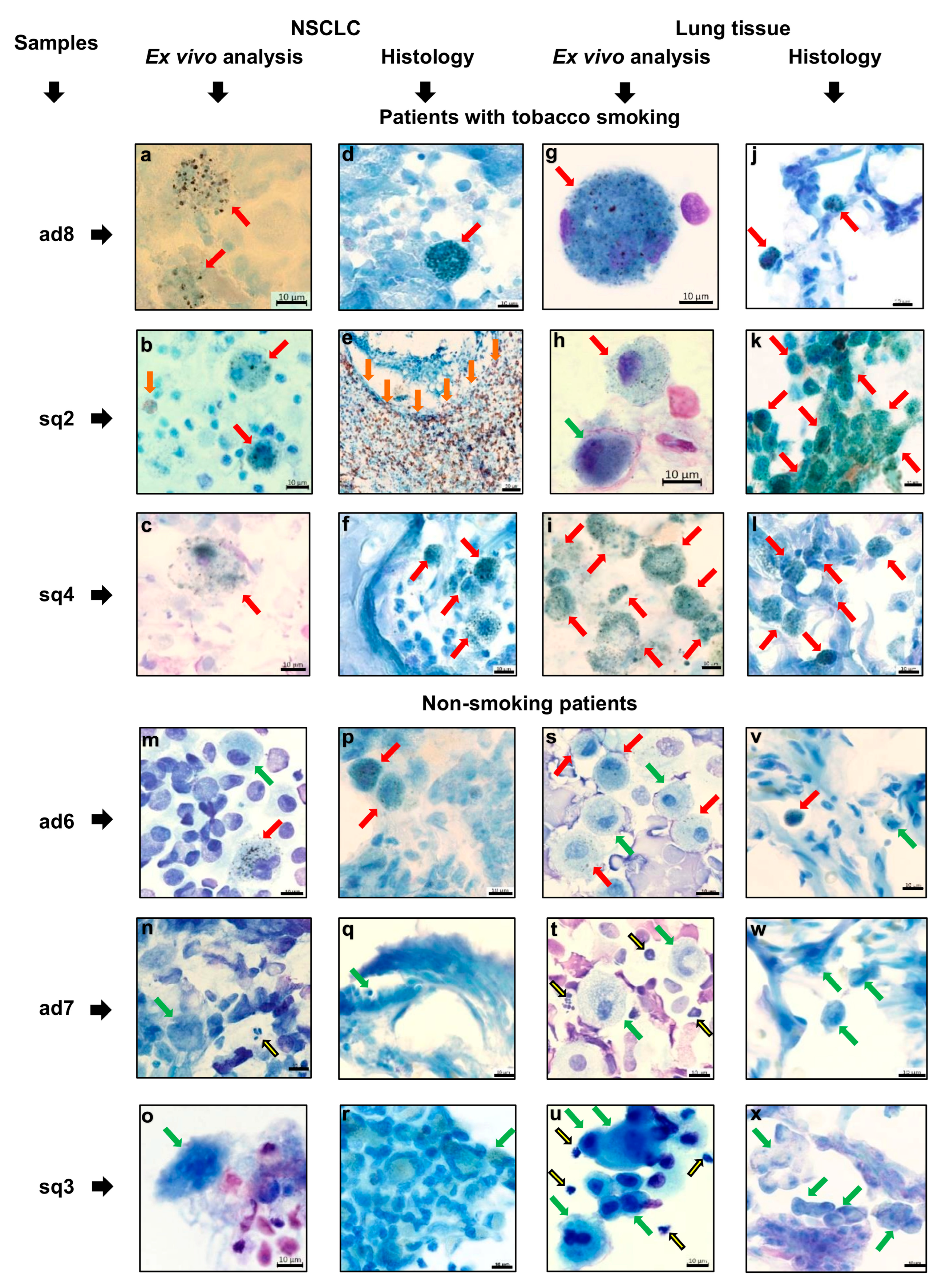 Cancers 16 02886 g004