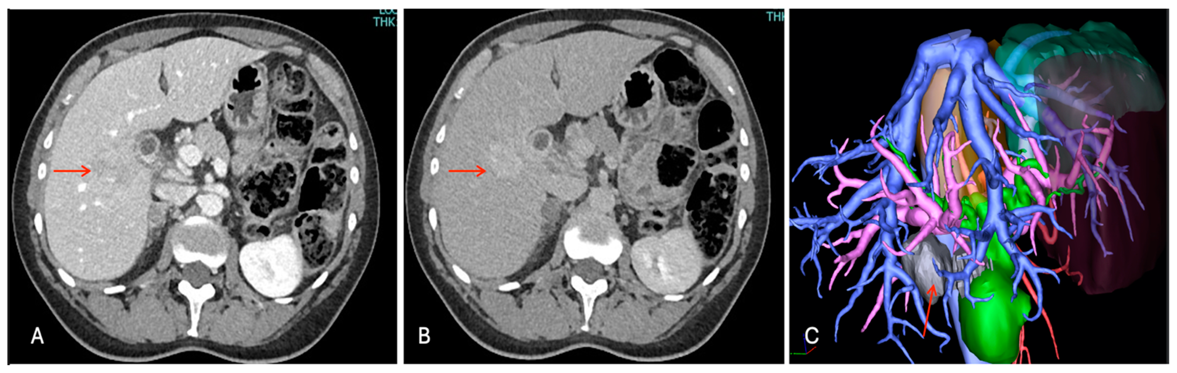 Cancers 16 02926 g003