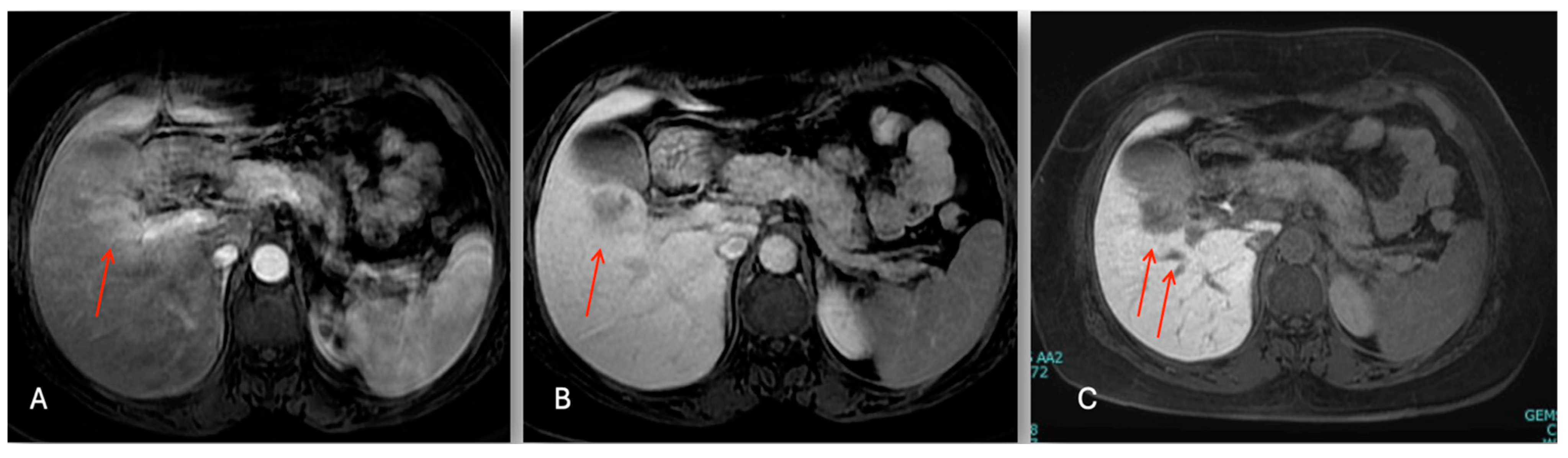 Cancers 16 02926 g004