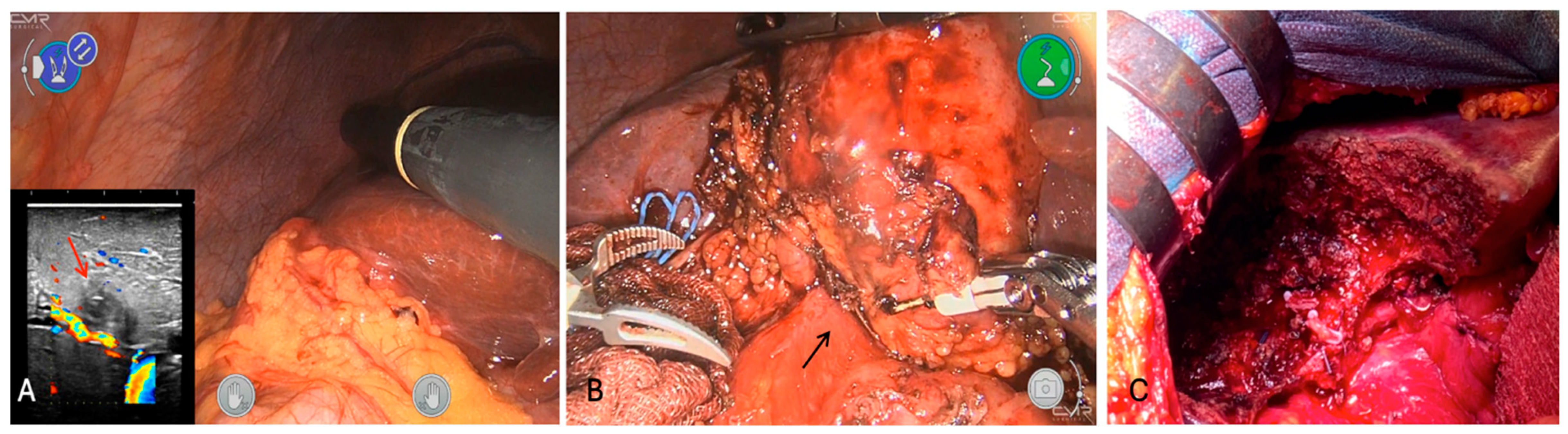 Cancers 16 02926 g007