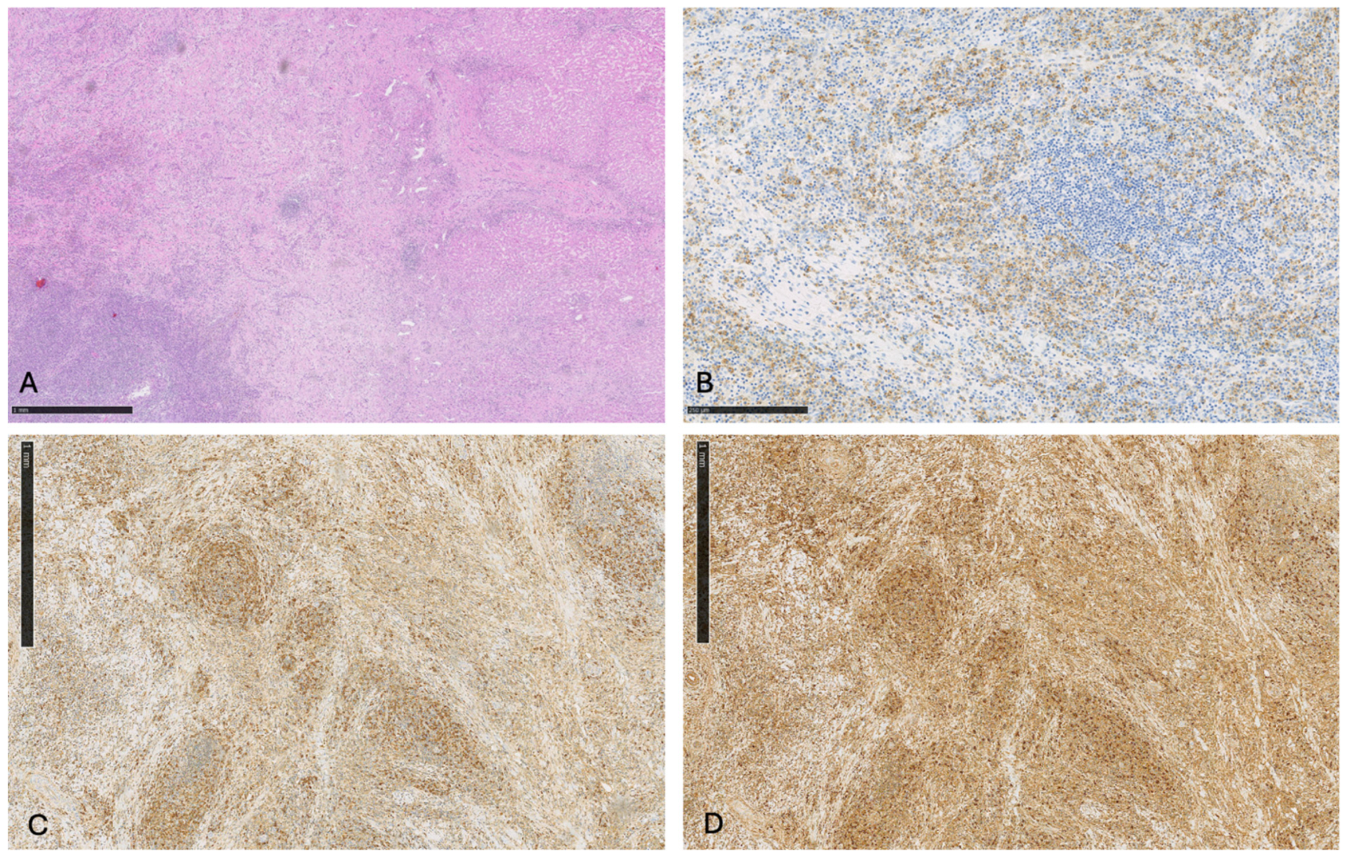 Cancers 16 02926 g008