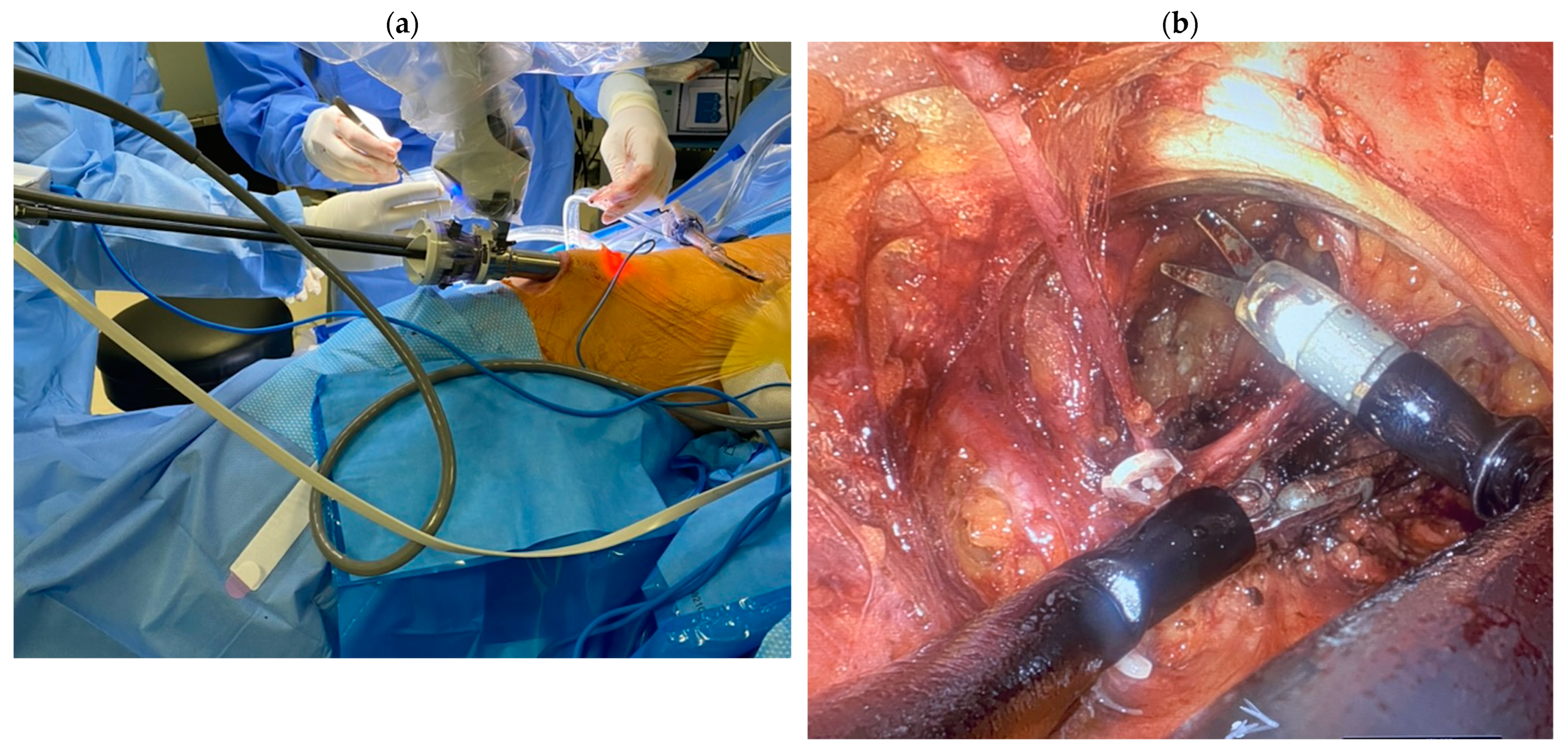 Cancers 16 02935 g004