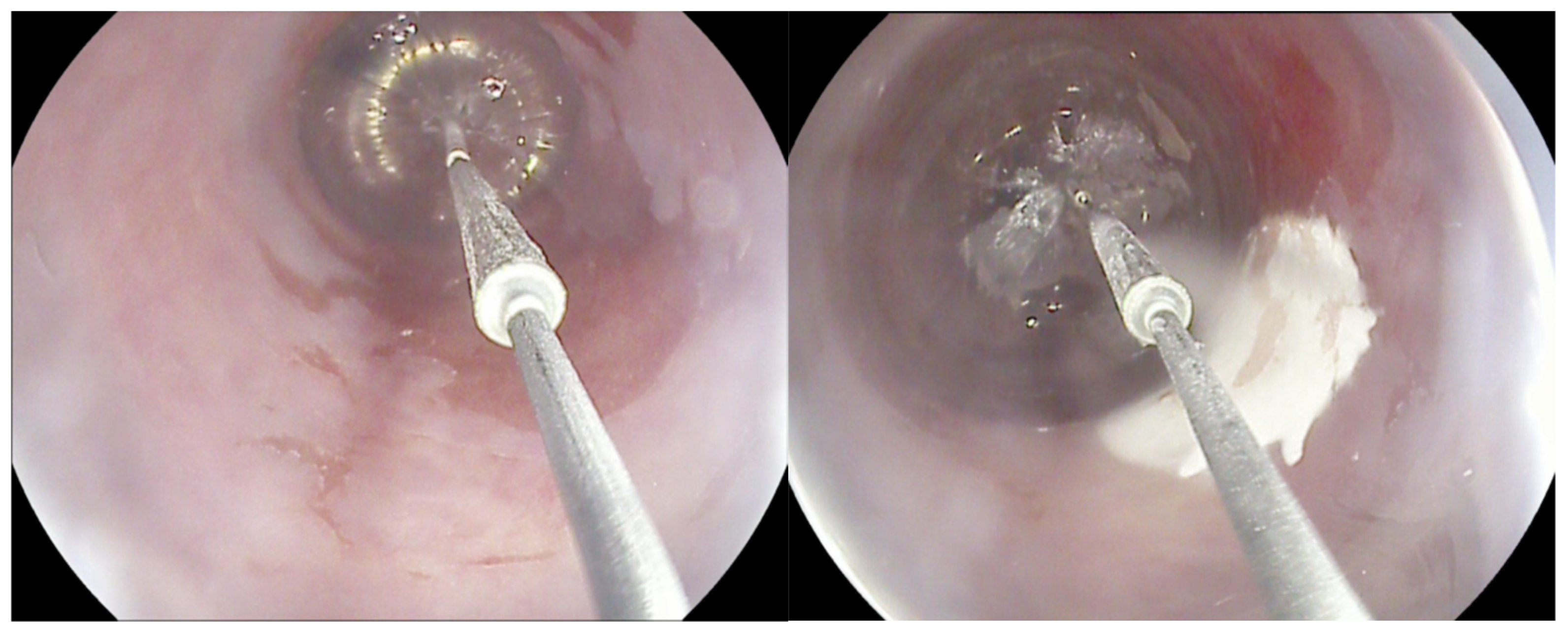 Cancers 16 02937 g001