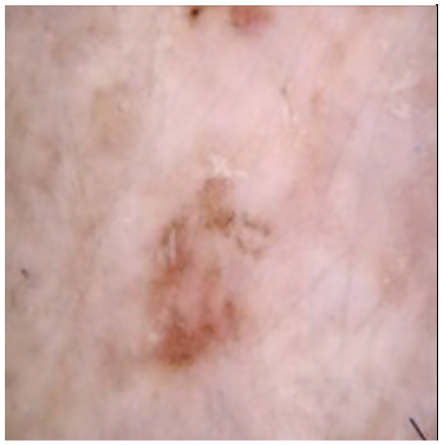 Cancers 16 02947 i003