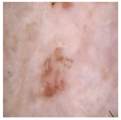 Cancers 16 02947 i007