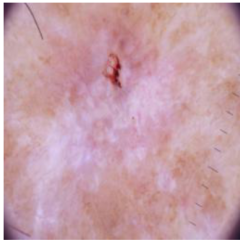 Cancers 16 02947 i010