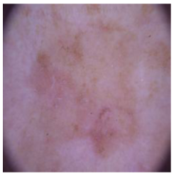 Cancers 16 02947 i013