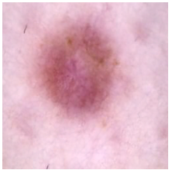 Cancers 16 02947 i018