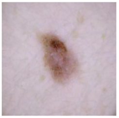 Cancers 16 02947 i021