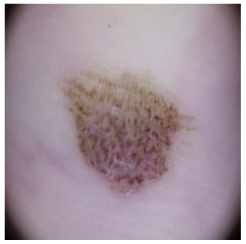 Cancers 16 02947 i022