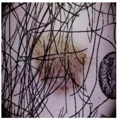 Cancers 16 02947 i023