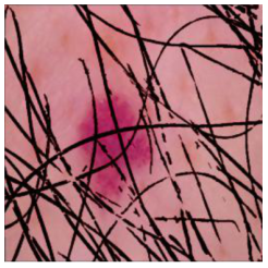 Cancers 16 02947 i026