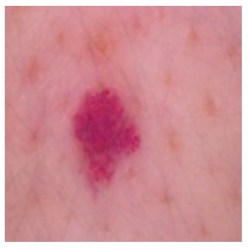 Cancers 16 02947 i027