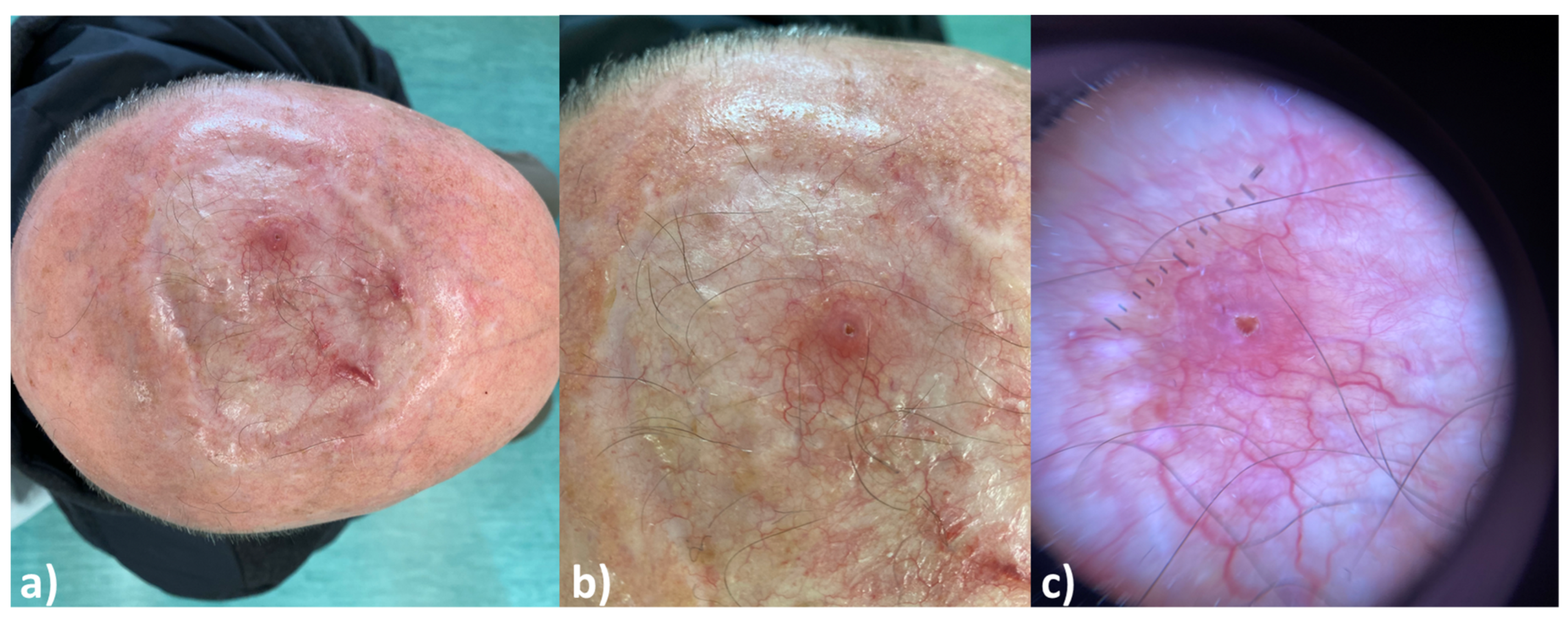 Cancers 16 02960 g001