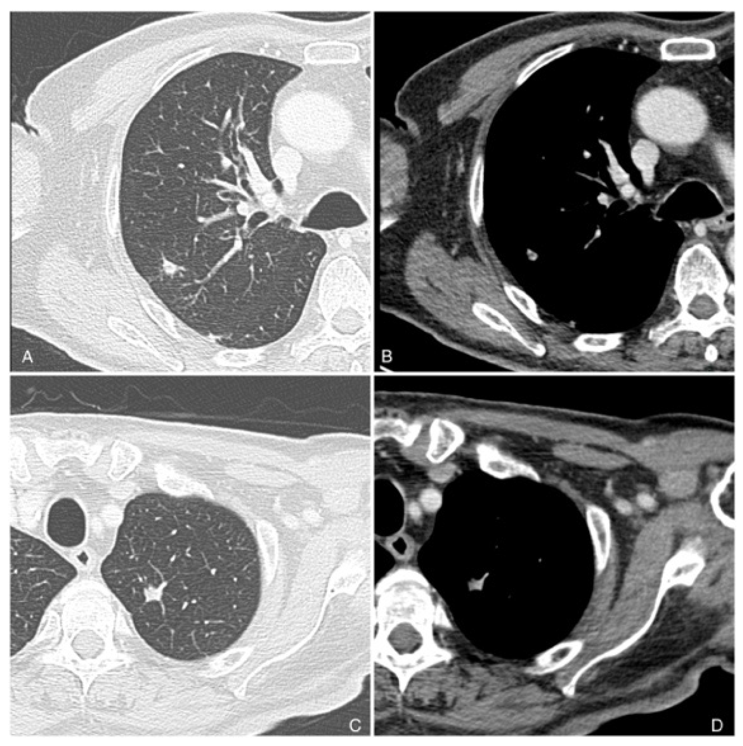 Cancers 16 02960 g004