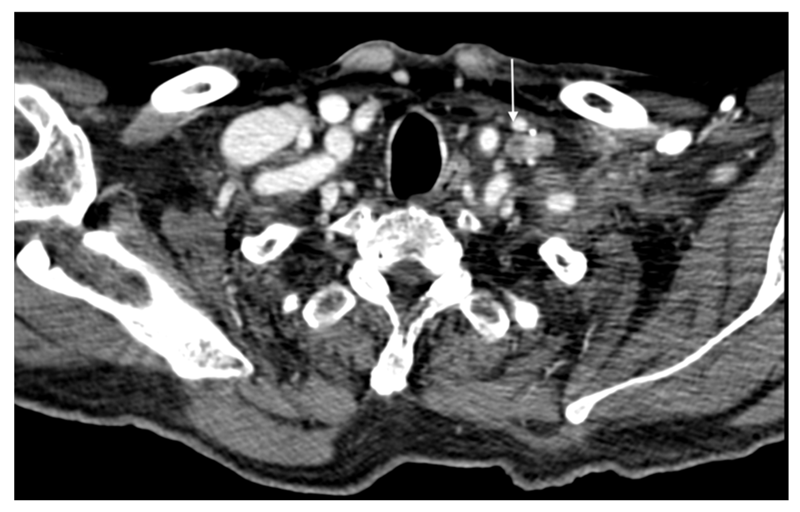 Cancers 16 02960 g005