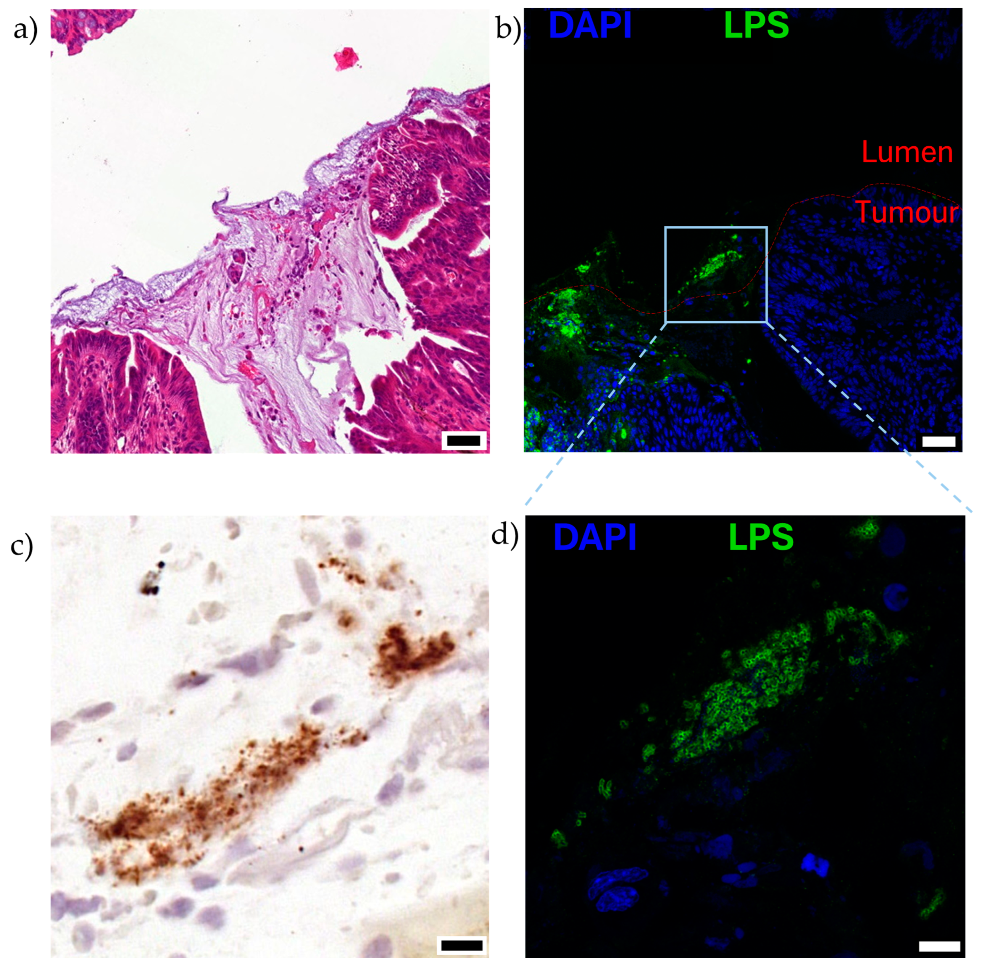 Cancers 16 02971 g004