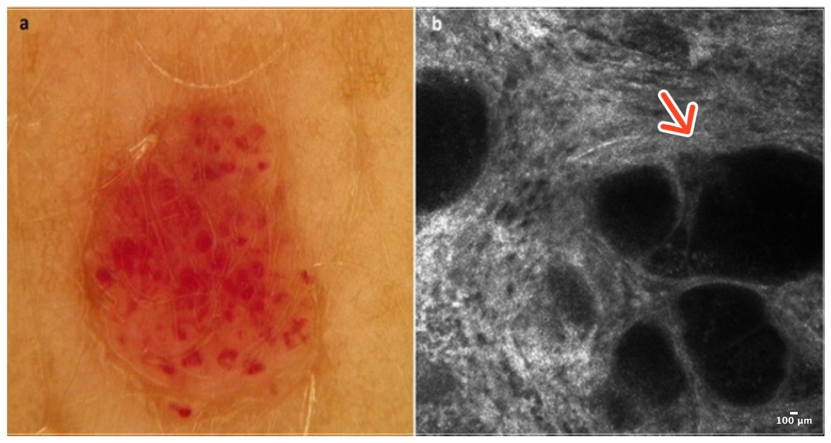 Cancers 16 02972 g001