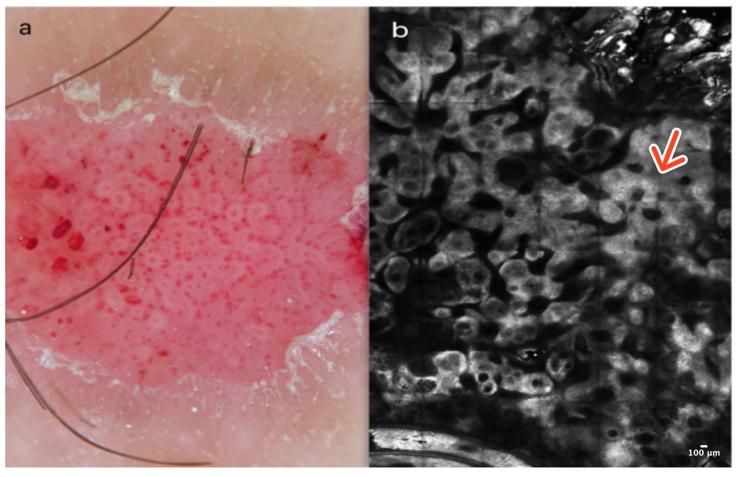 Cancers 16 02972 g002