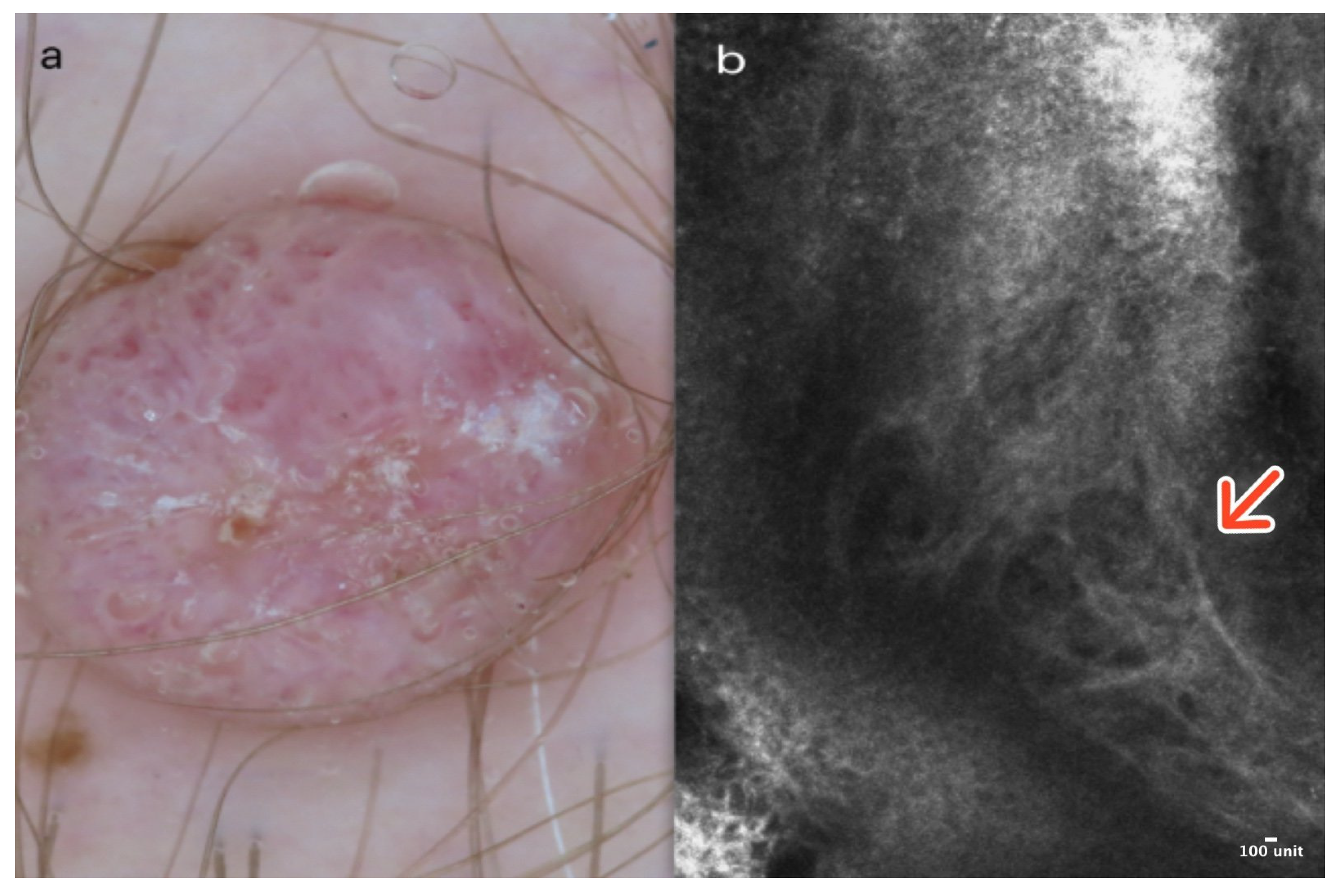 Cancers 16 02972 g005