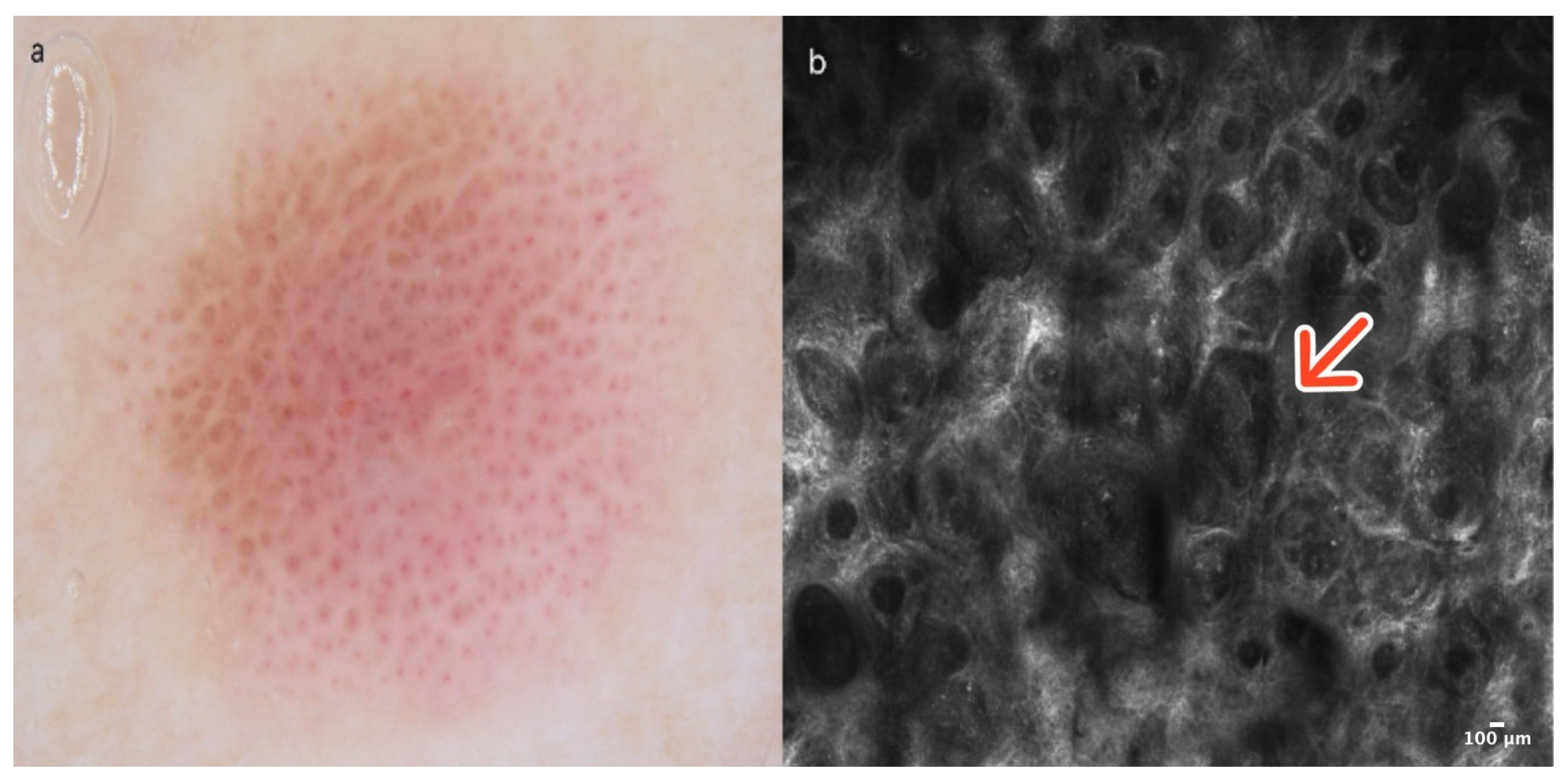 Cancers 16 02972 g006