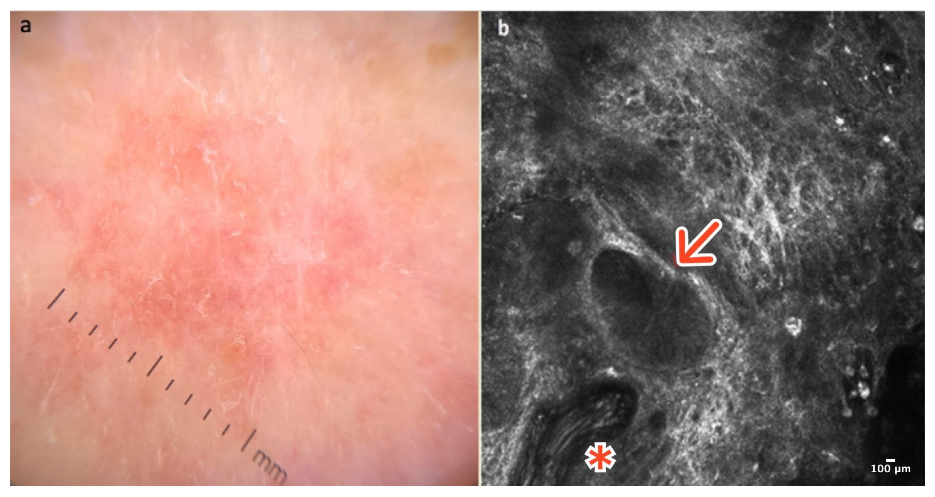 Cancers 16 02972 g007