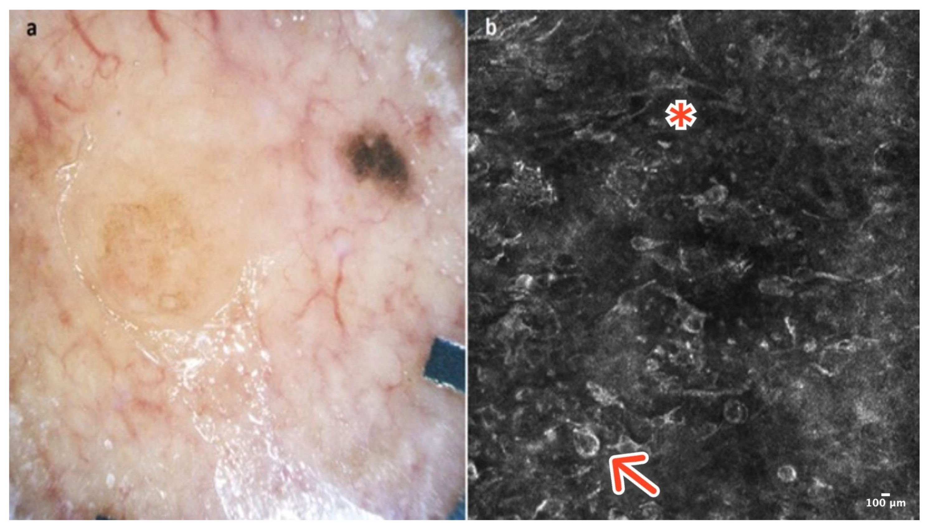 Cancers 16 02972 g009