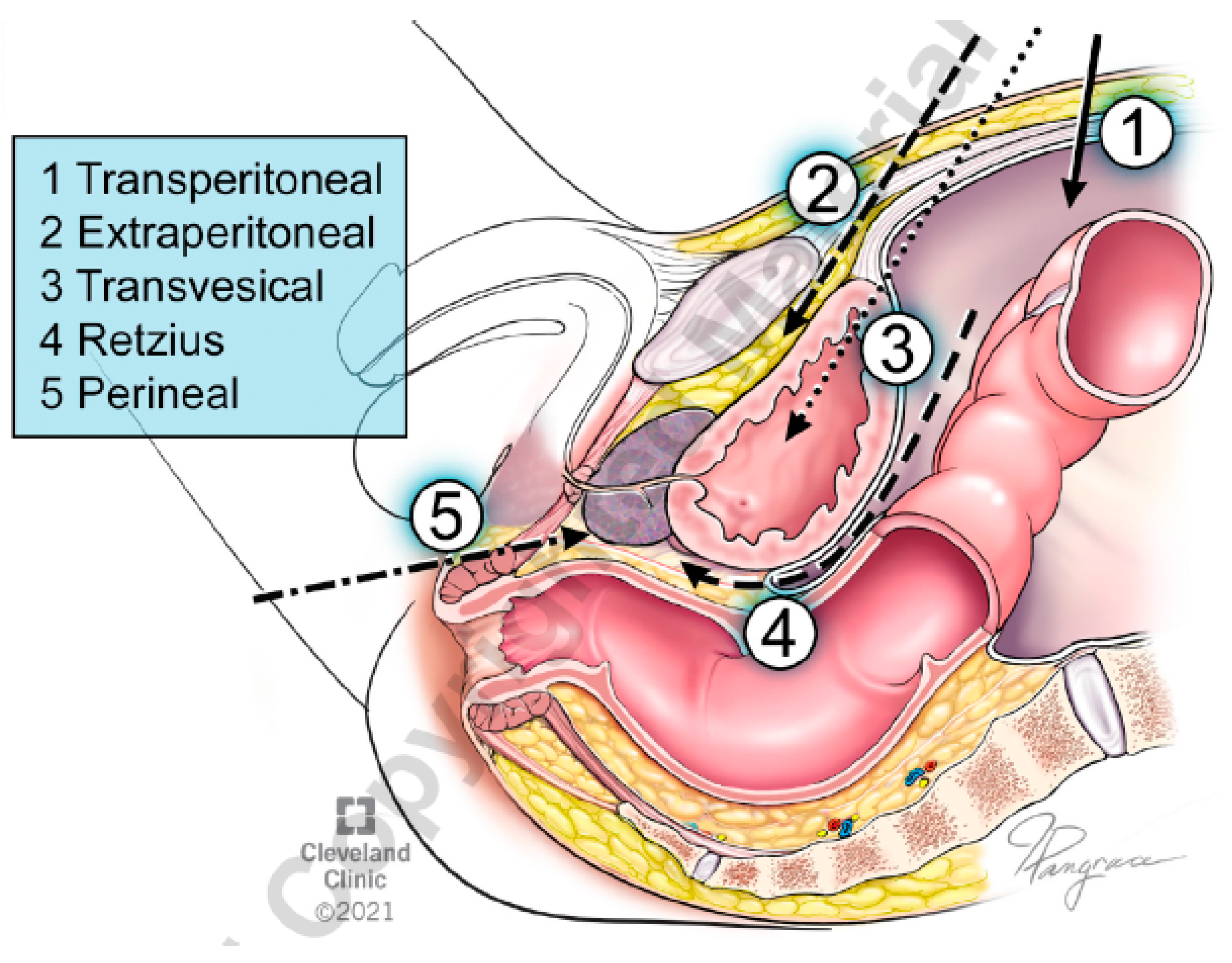 Cancers 16 02994 g001