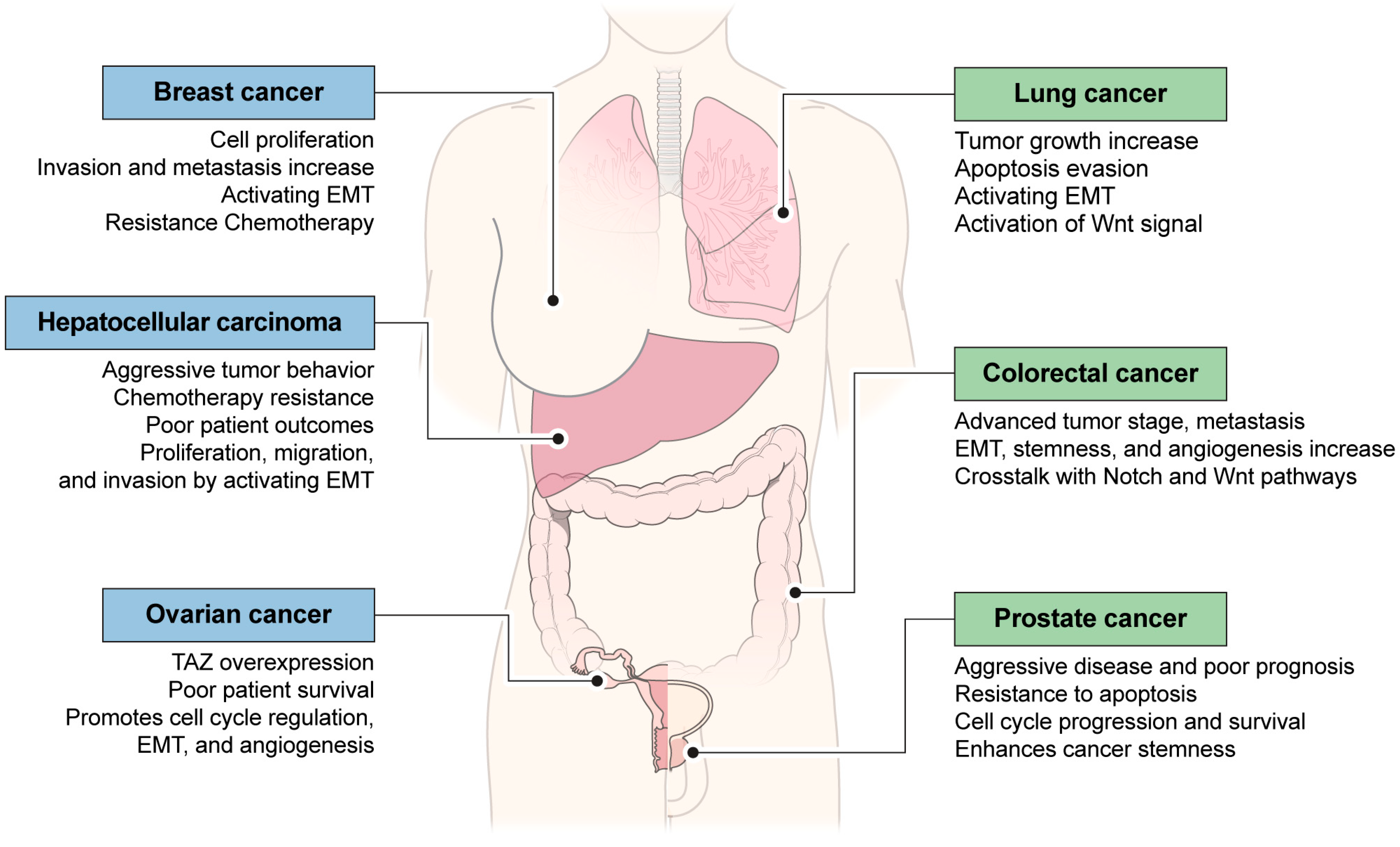 Cancers 16 03030 g002 Cancers 16 03030 g002