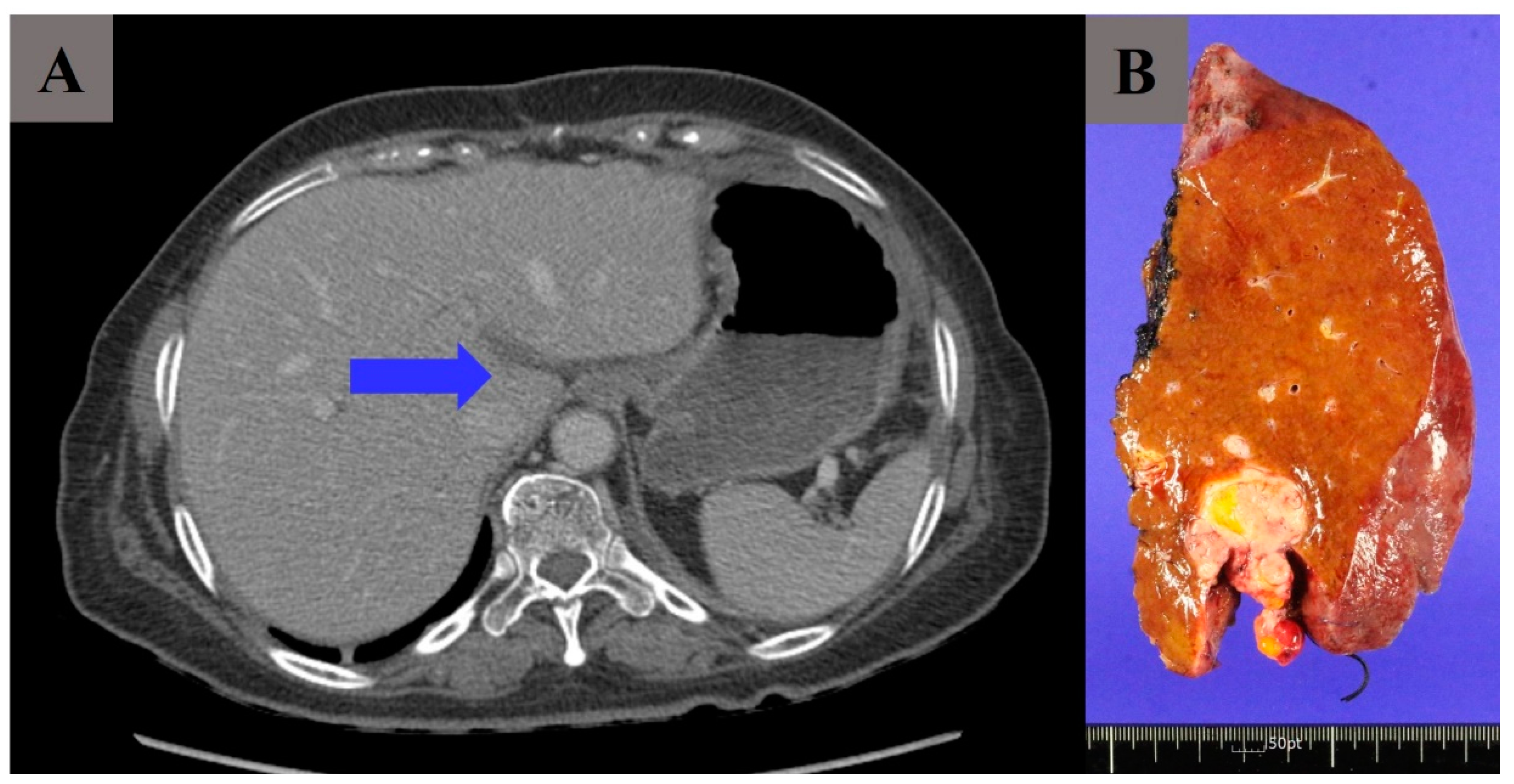 Cancers 16 03036 g001