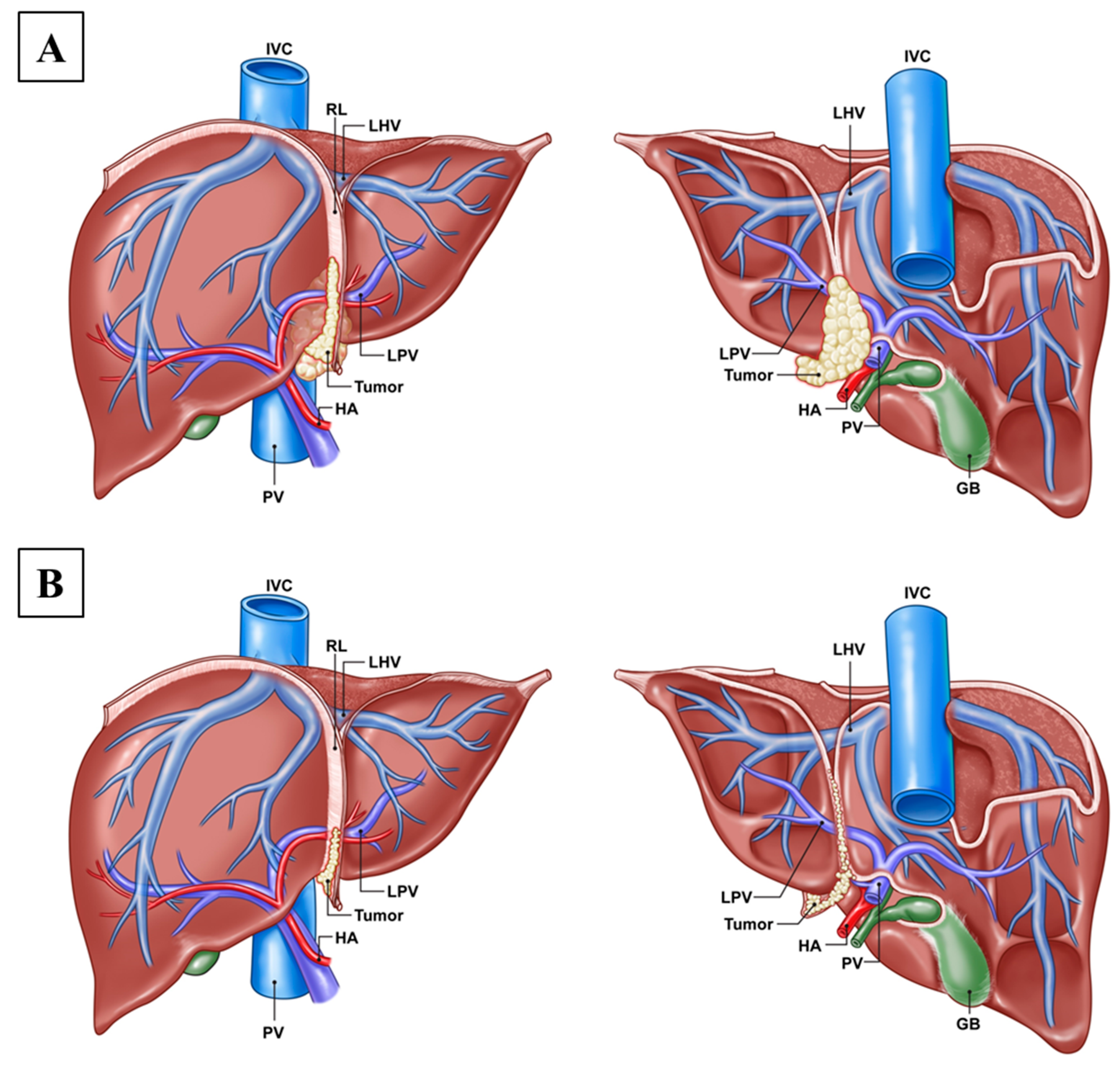 Cancers 16 03036 g002
