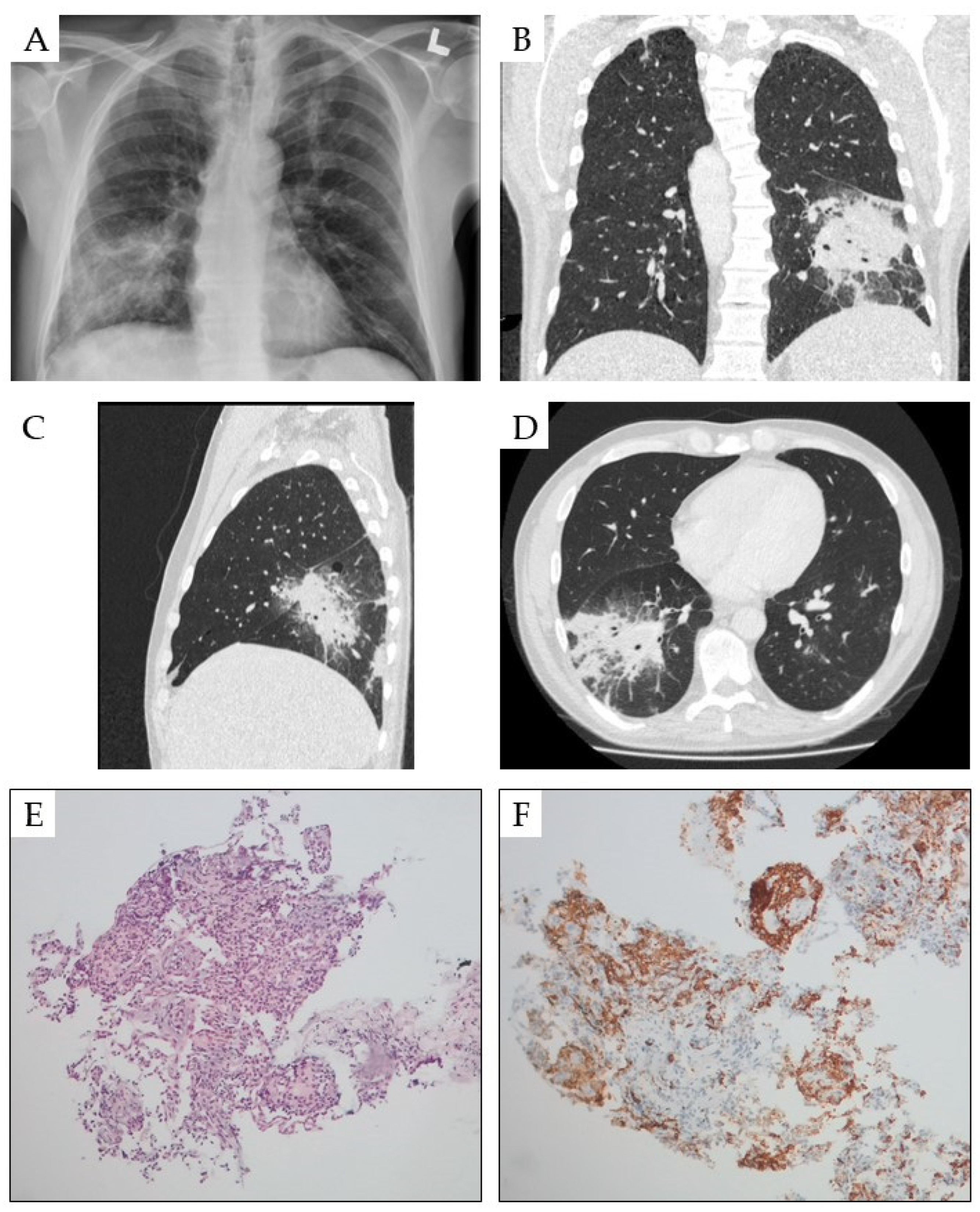 Cancers 16 03054 g002