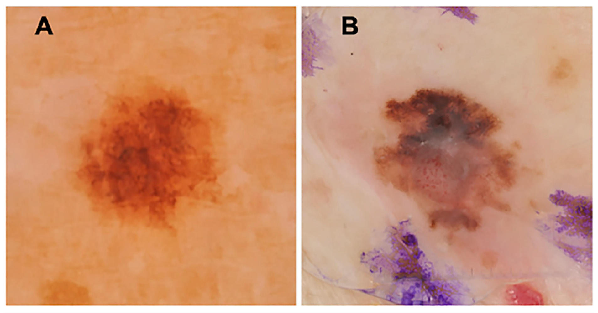 Cancers 16 03077 g001