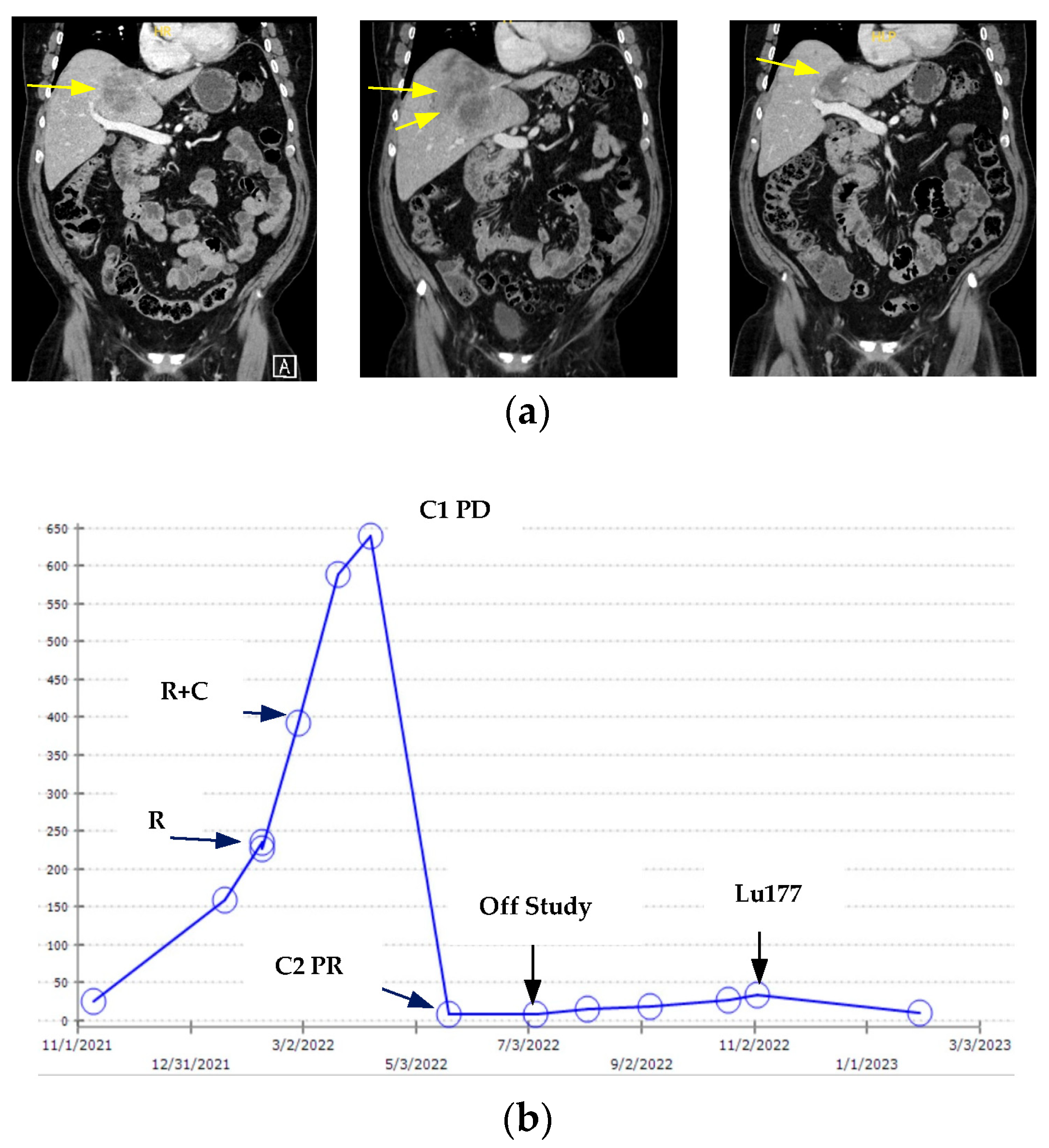 Cancers 16 03098 g001