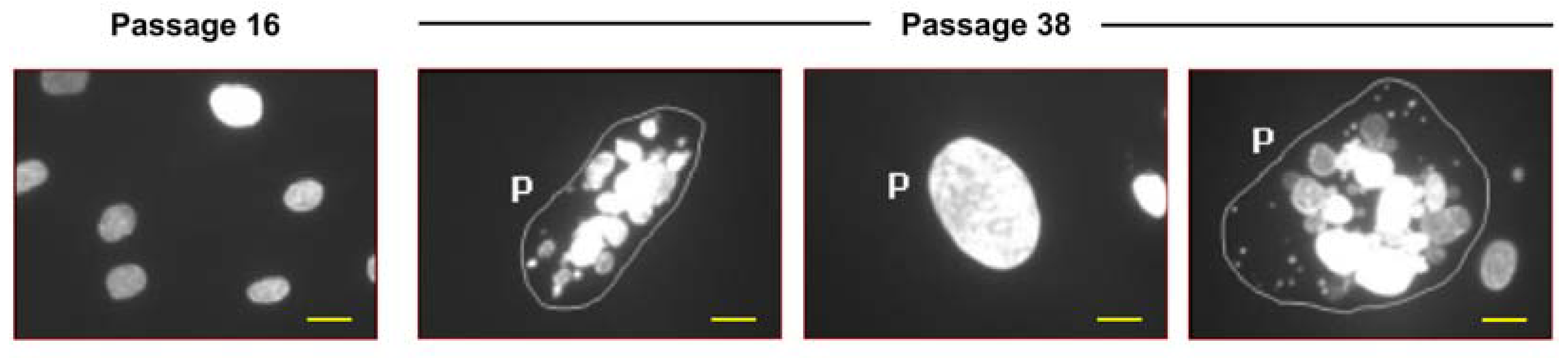 Cancers 16 03106 g004