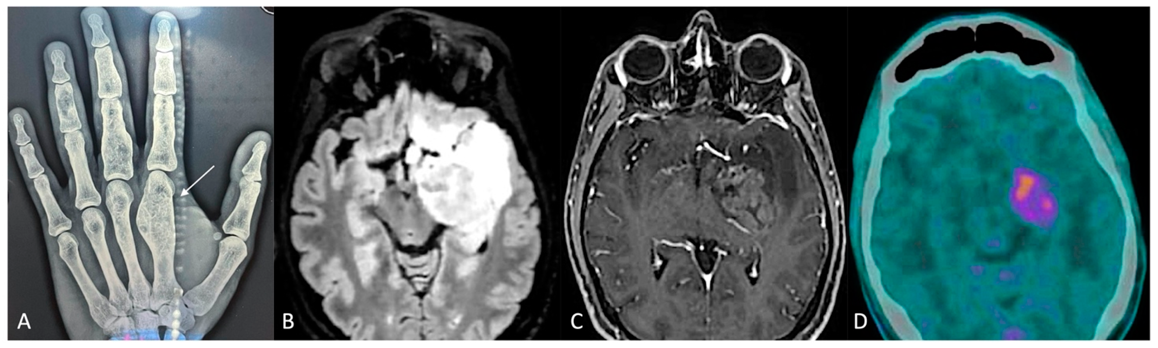 Cancers 16 03125 g002