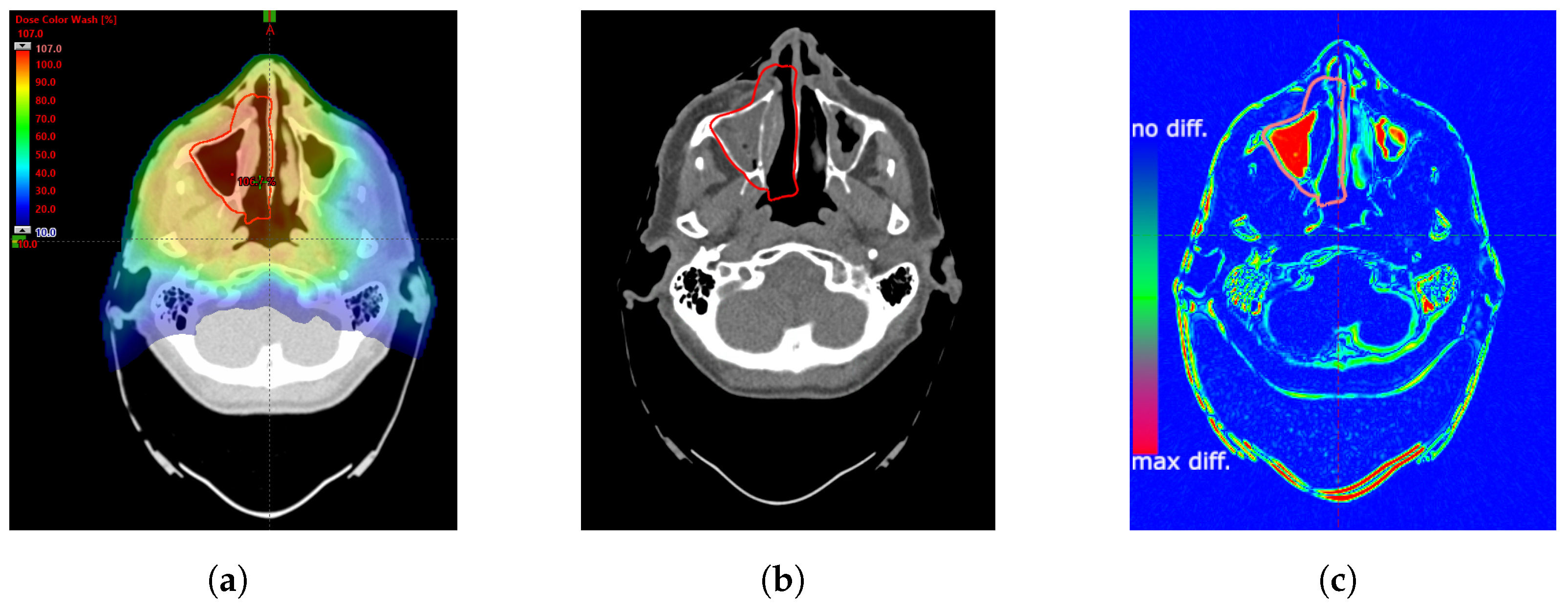 Cancers 16 03128 g001