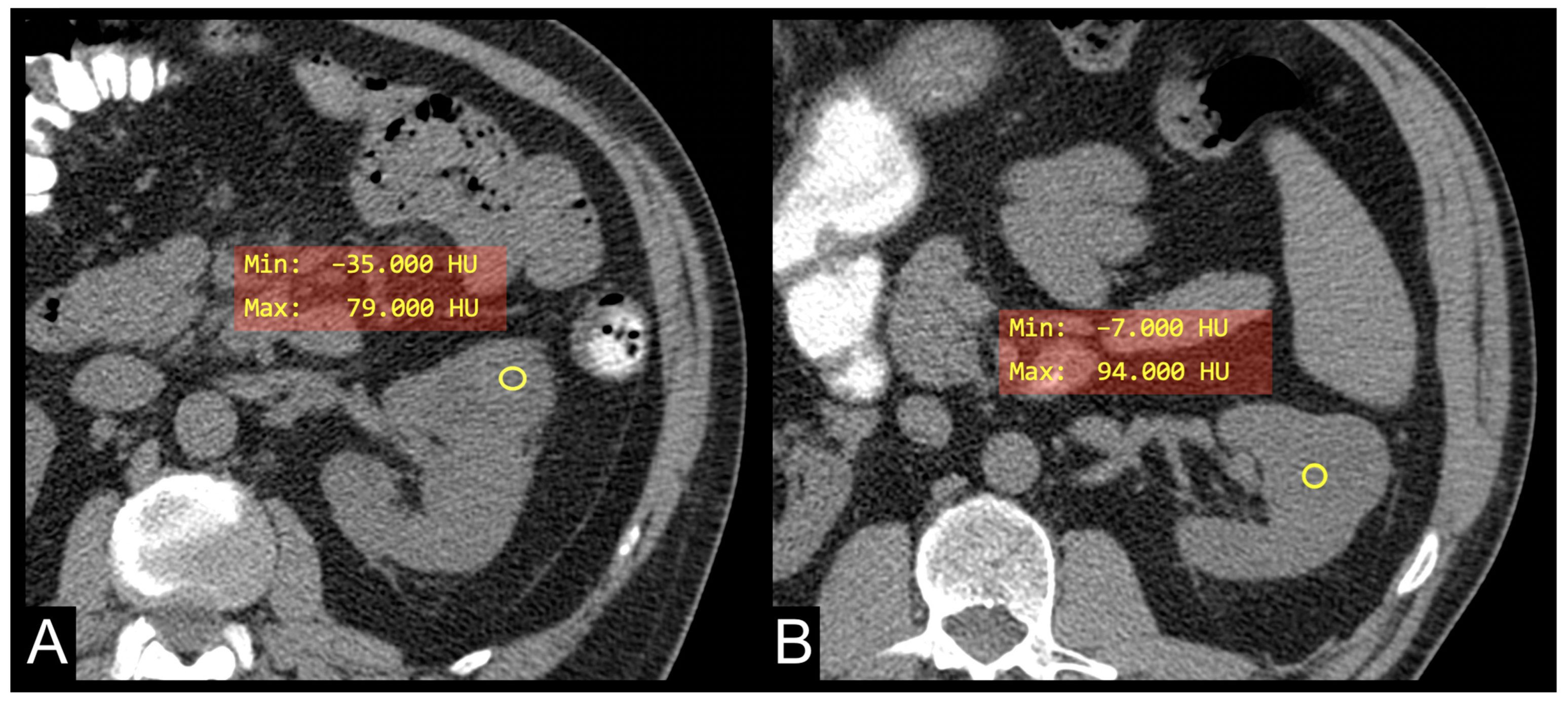 Cancers 16 03164 g002