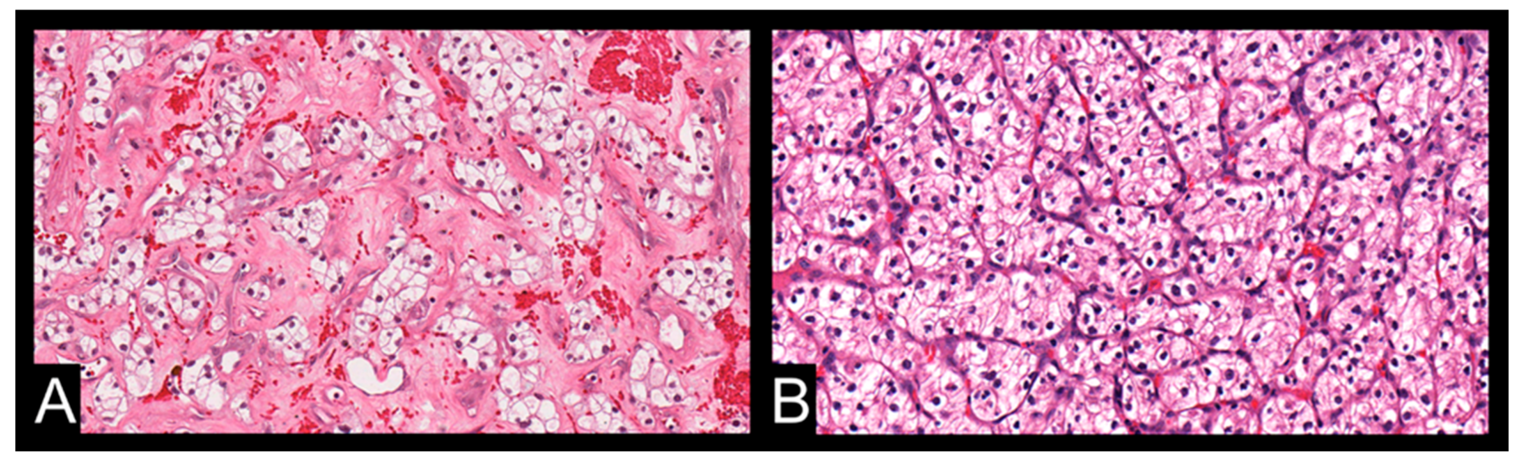Cancers 16 03164 g003