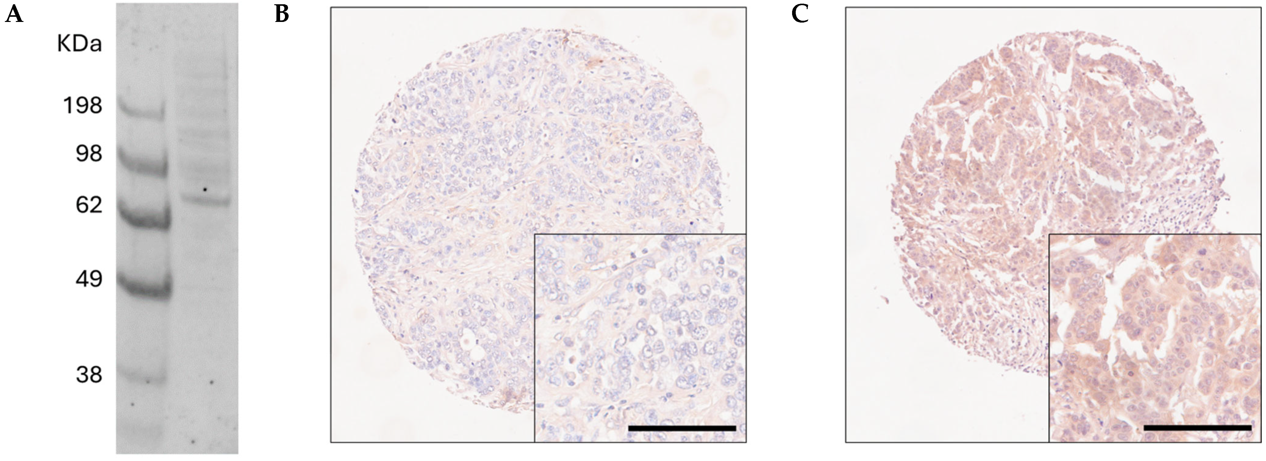 Cancers 16 03206 g001