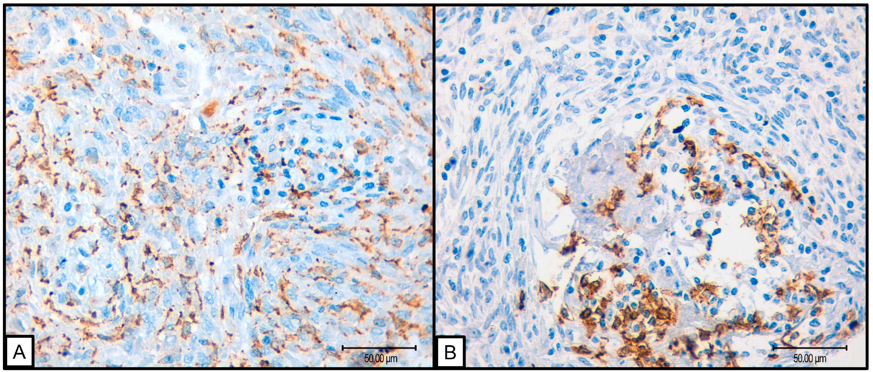 Cancers 16 03222 g002