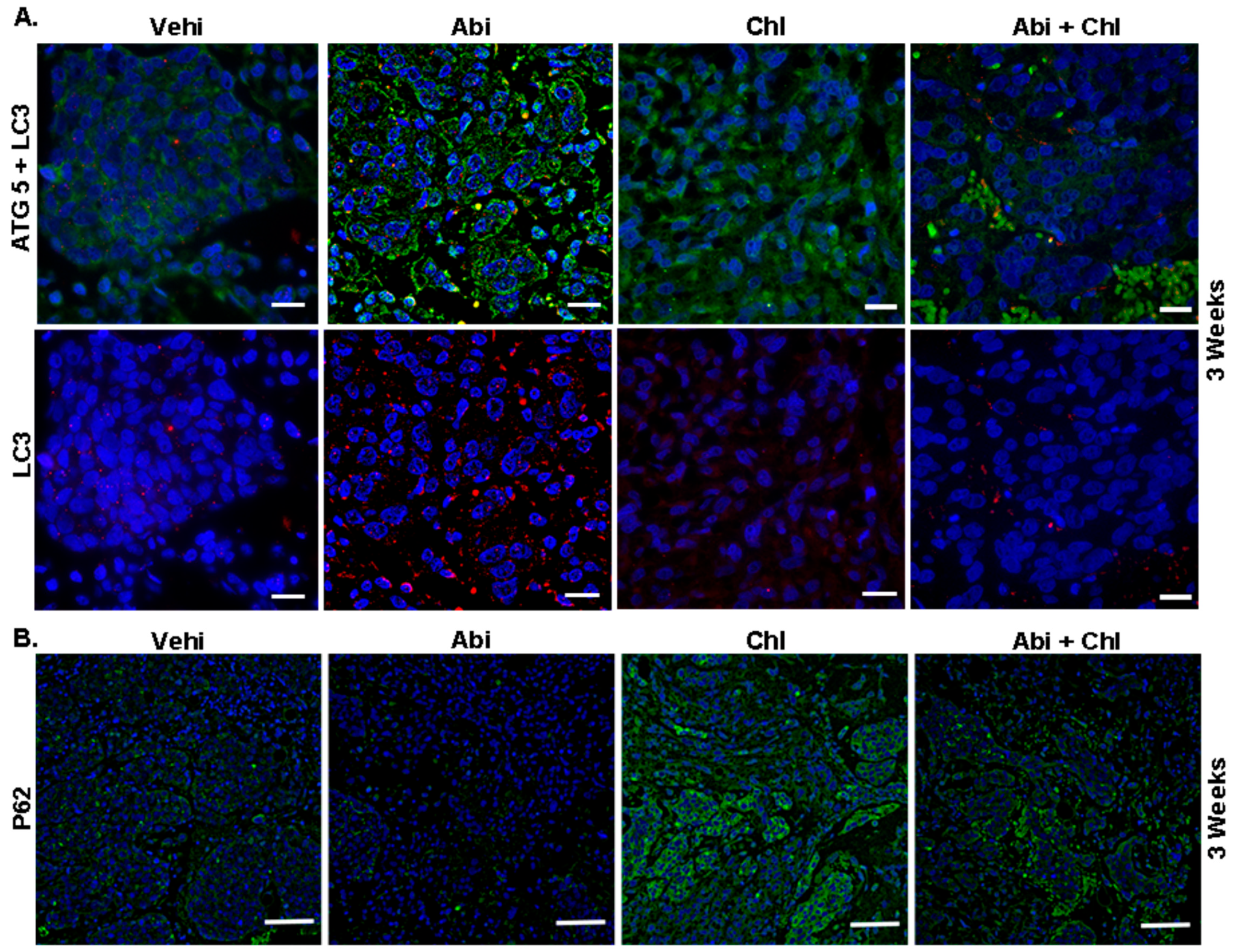 Cancers 16 03261 g003