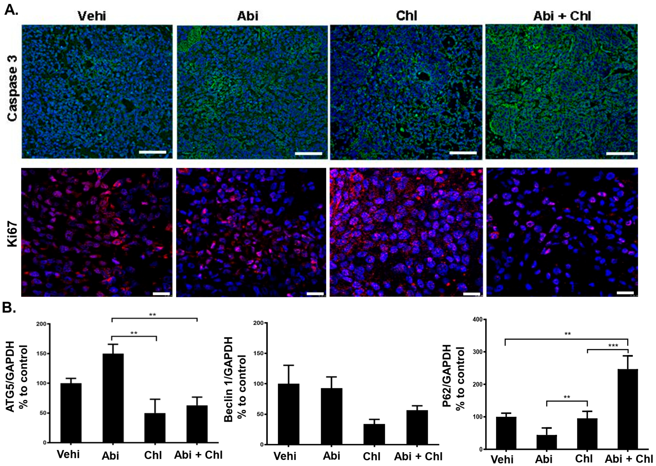 Cancers 16 03261 g004