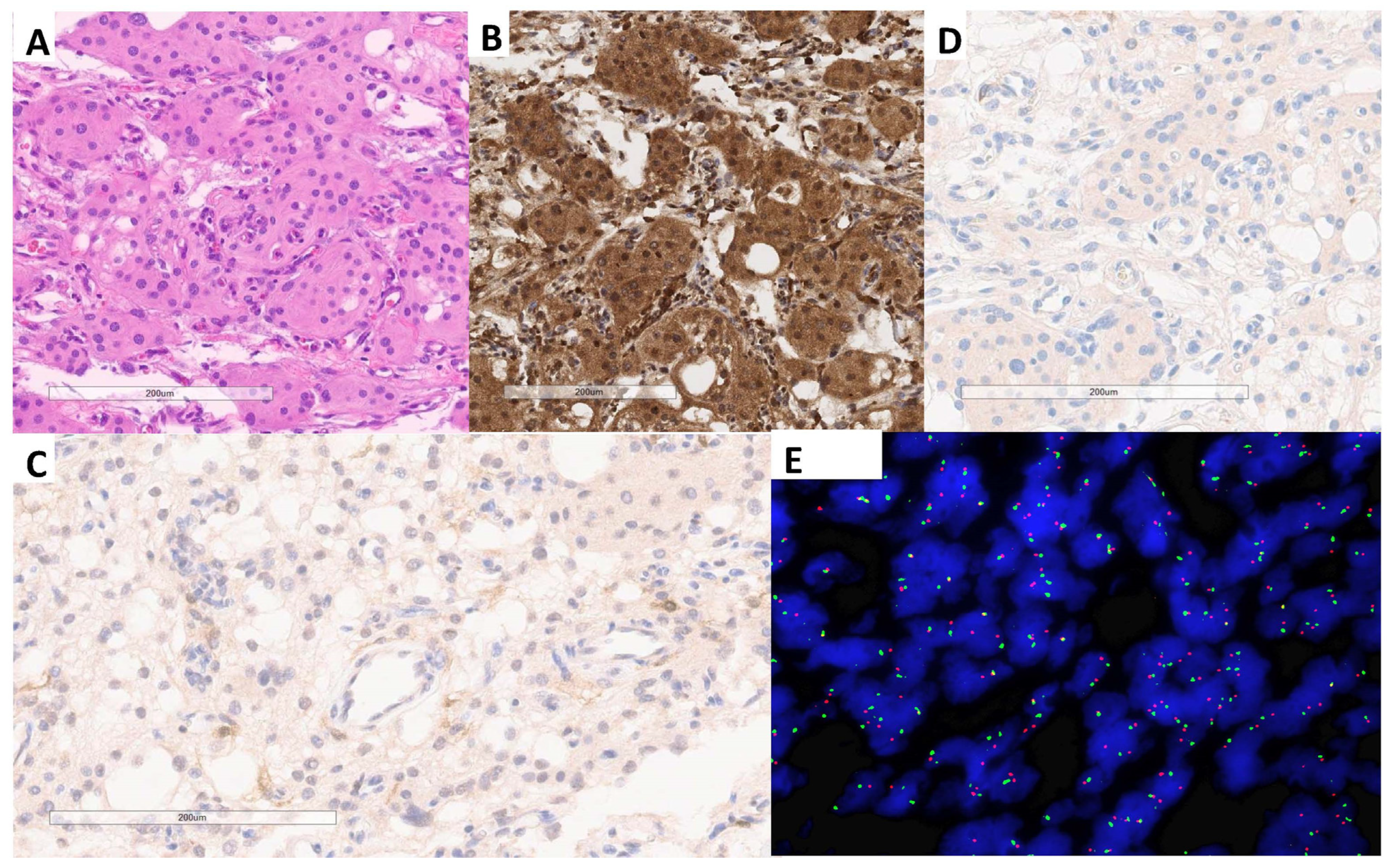 Cancers 16 03299 g001