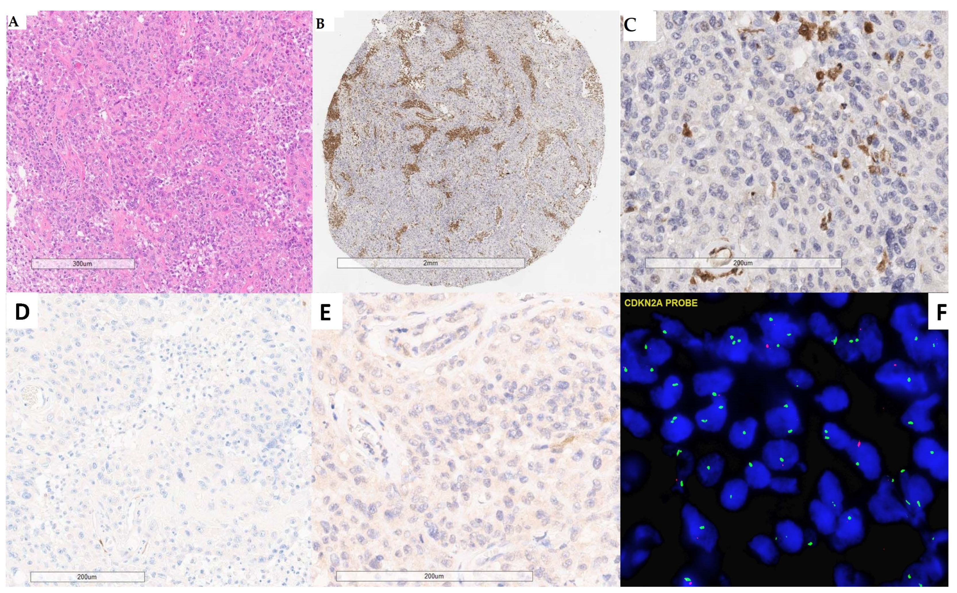 Cancers 16 03299 g002