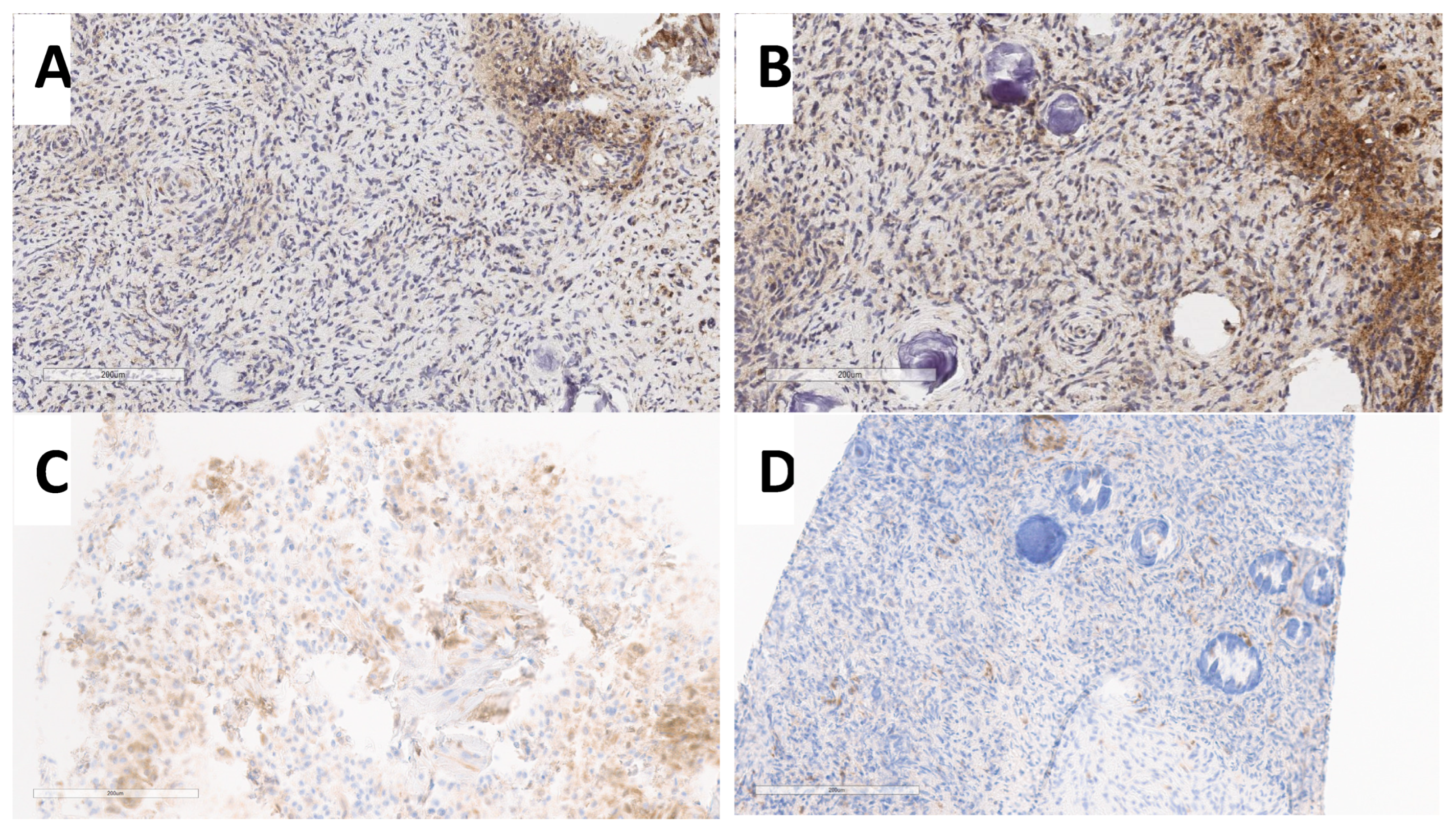 Cancers 16 03299 g003a