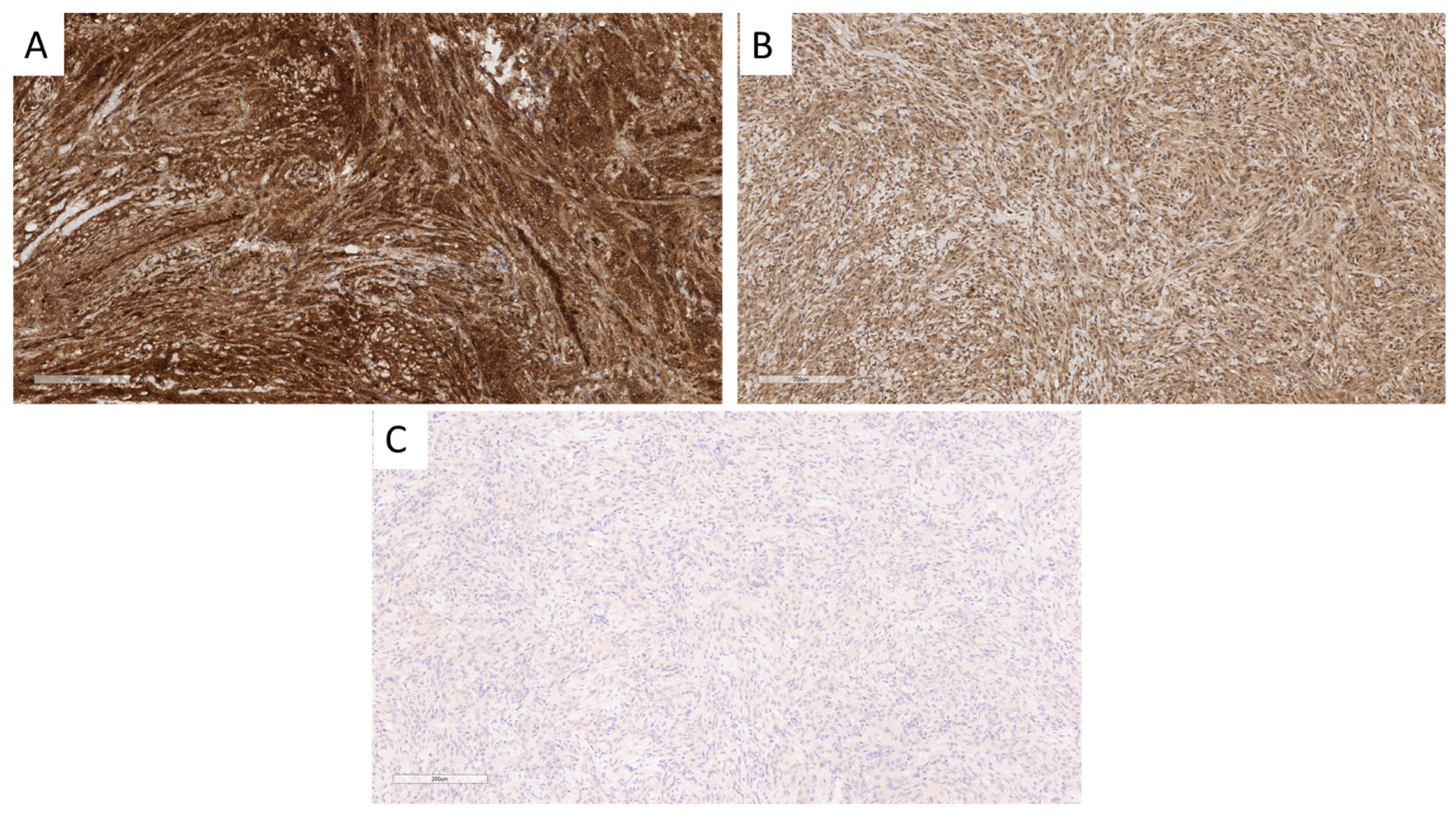 Cancers 16 03299 g004