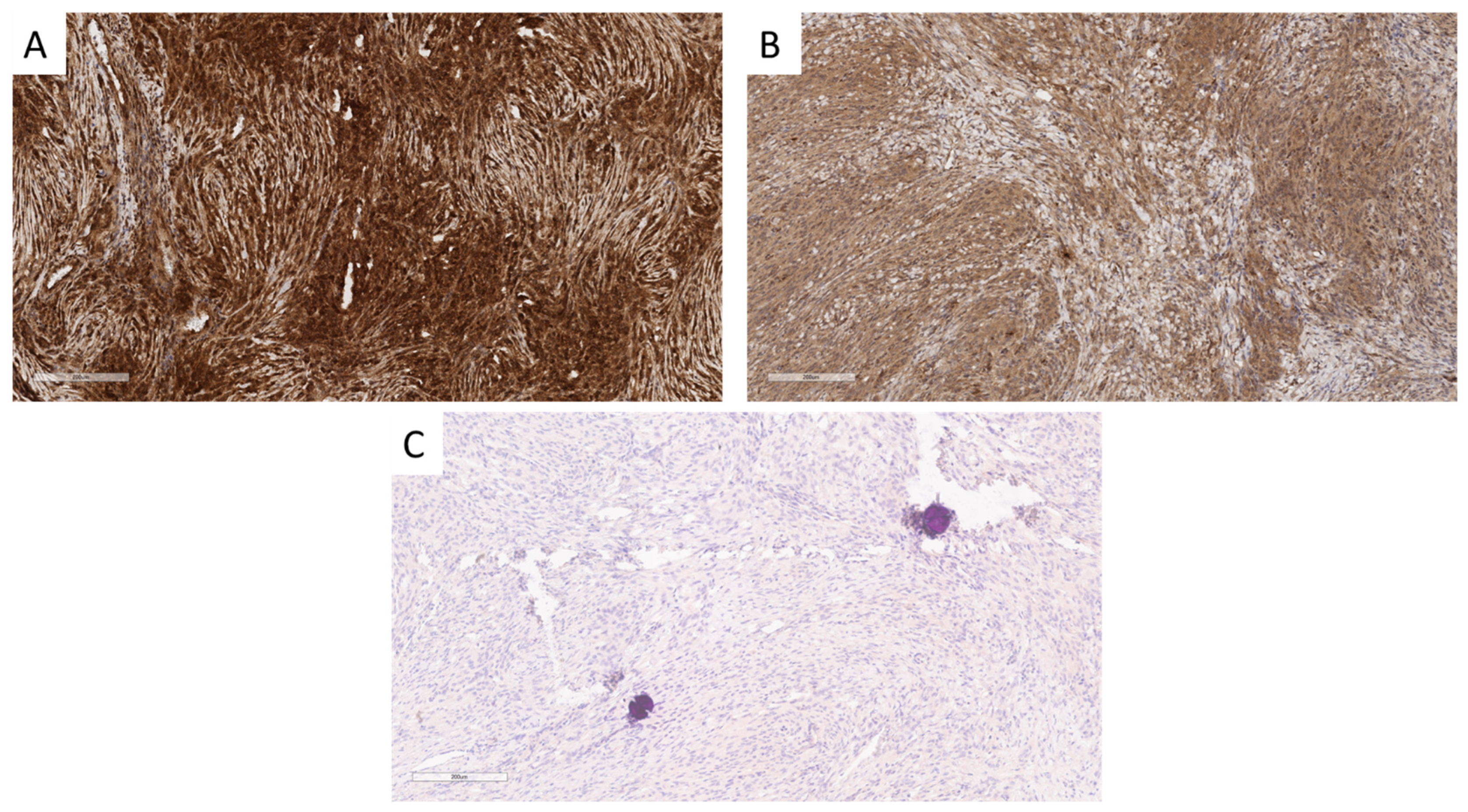 Cancers 16 03299 g005