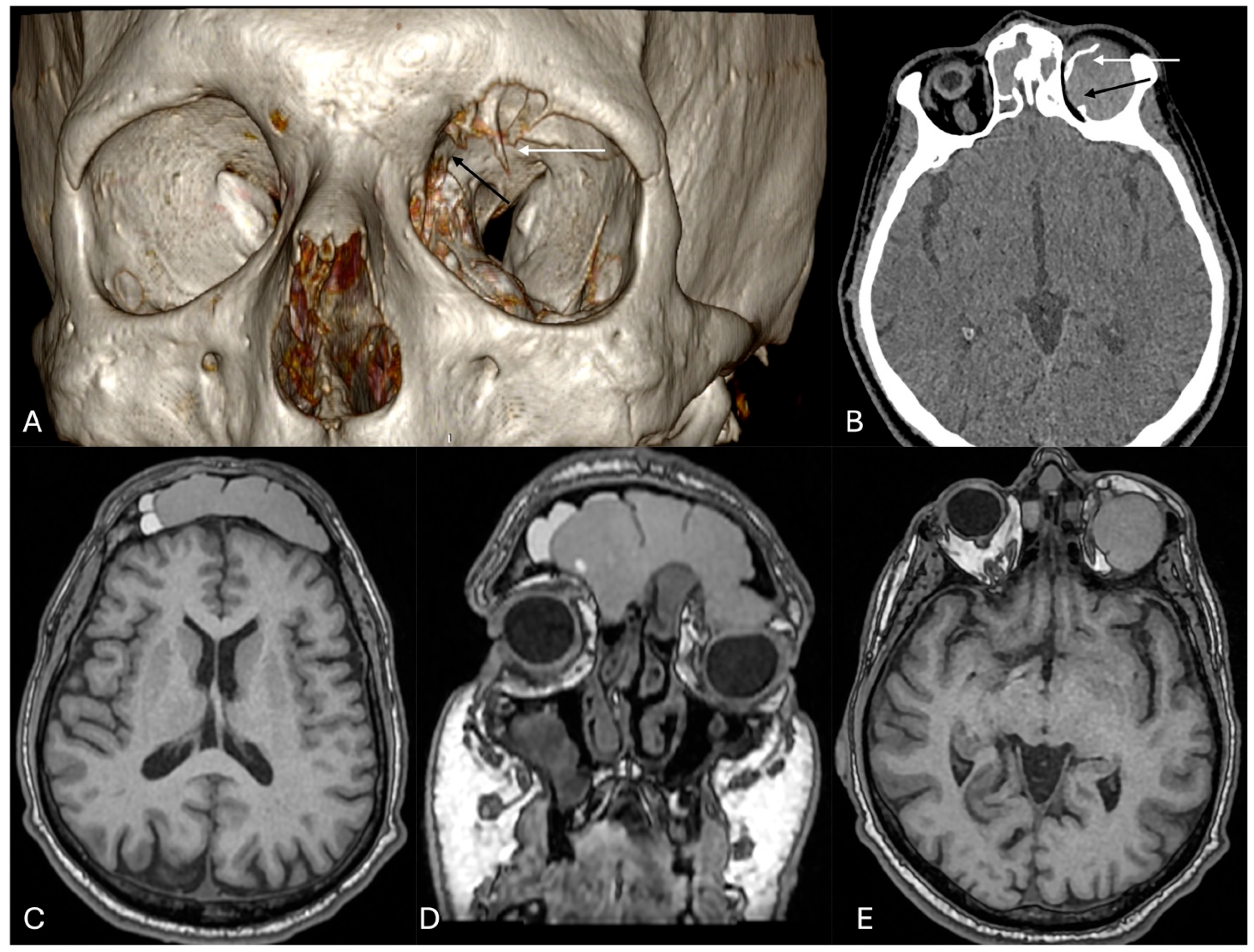 Cancers 16 03316 g002